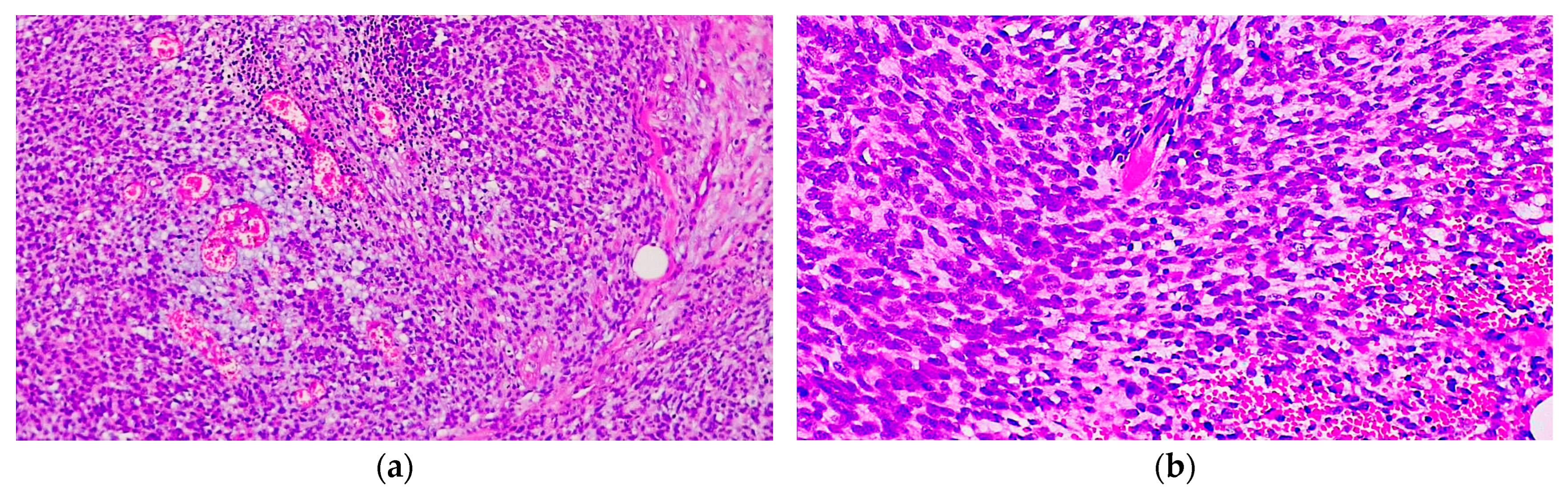 Diagnostics 14 01323 g006