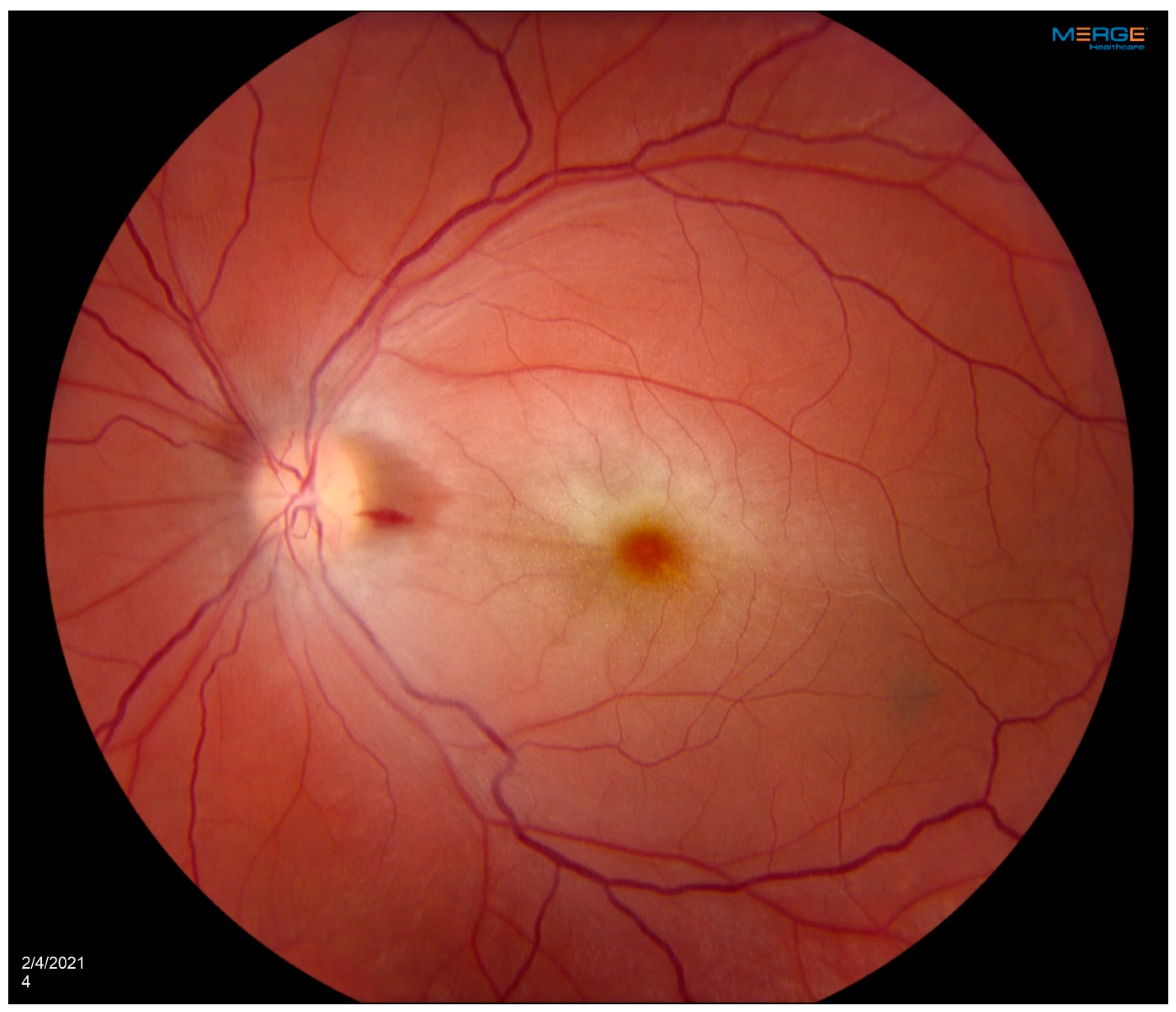 Diagnostics 14 01329 g001