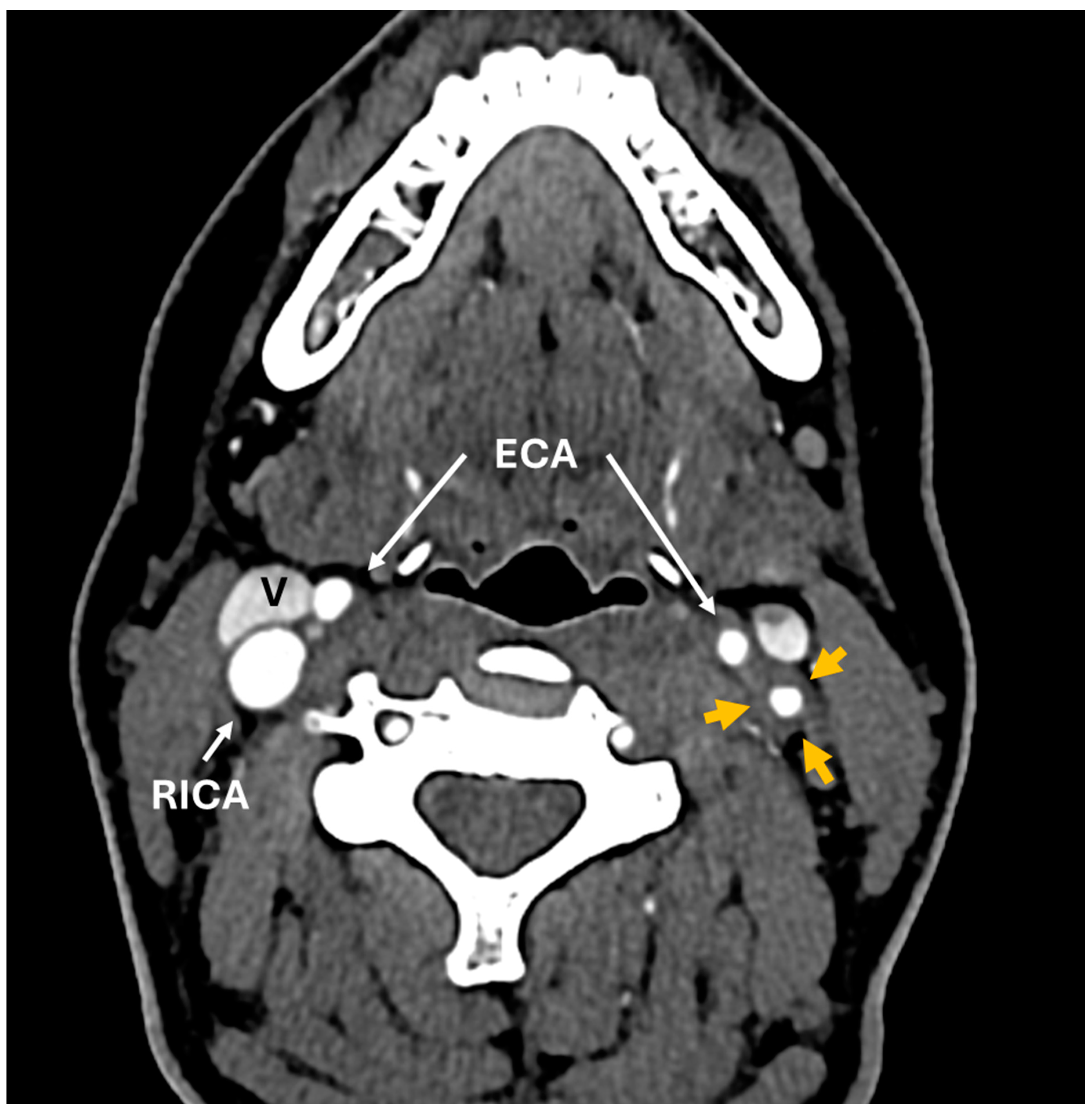 Diagnostics 14 01329 g004