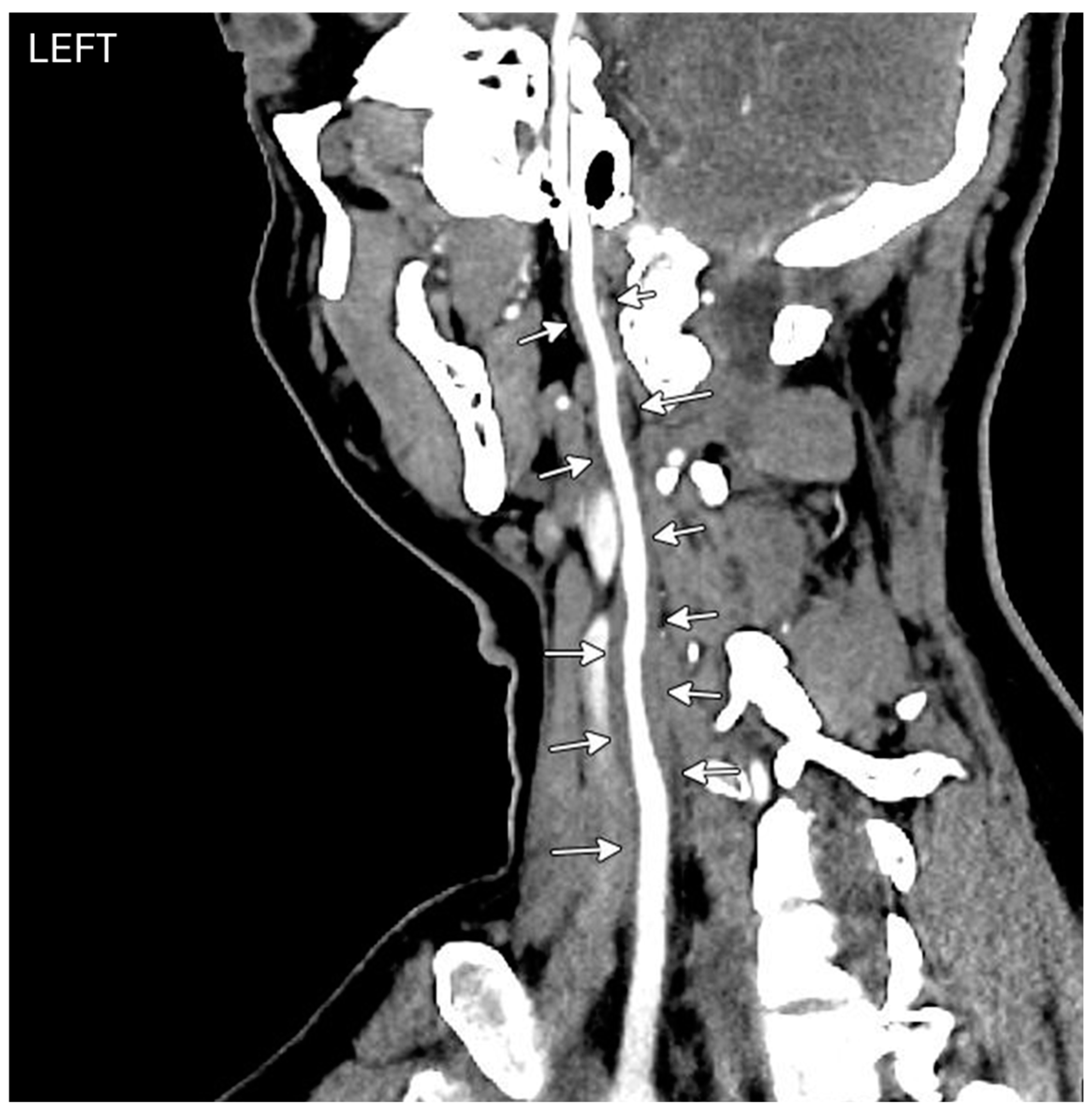 Diagnostics 14 01329 g005