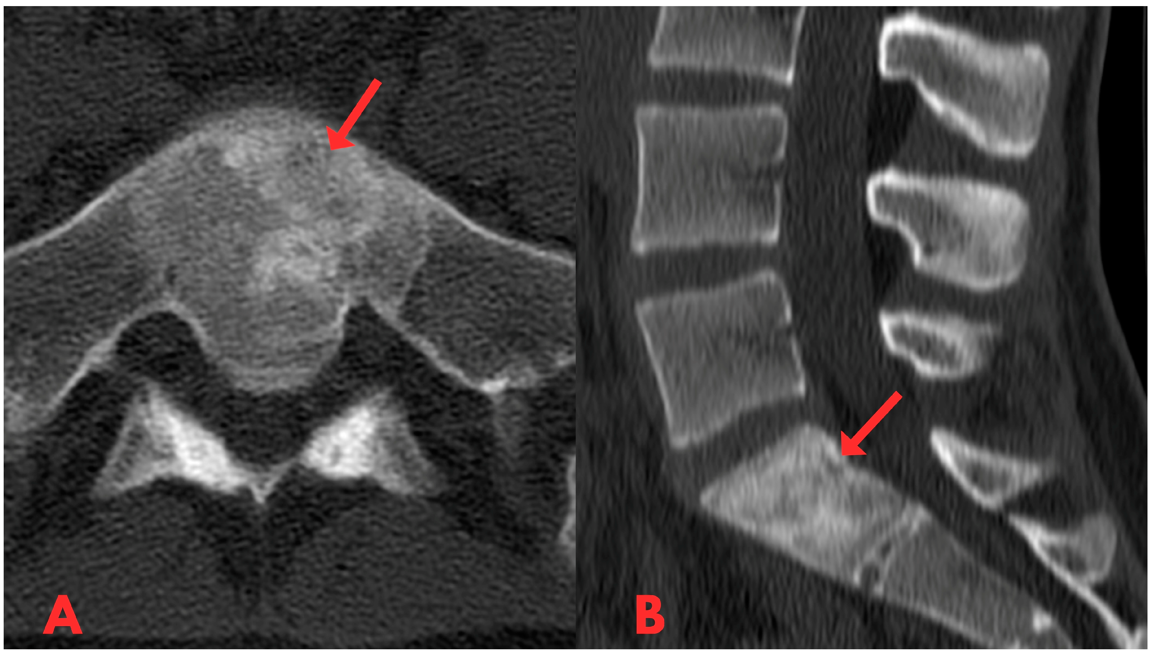 Diagnostics 14 01330 g001