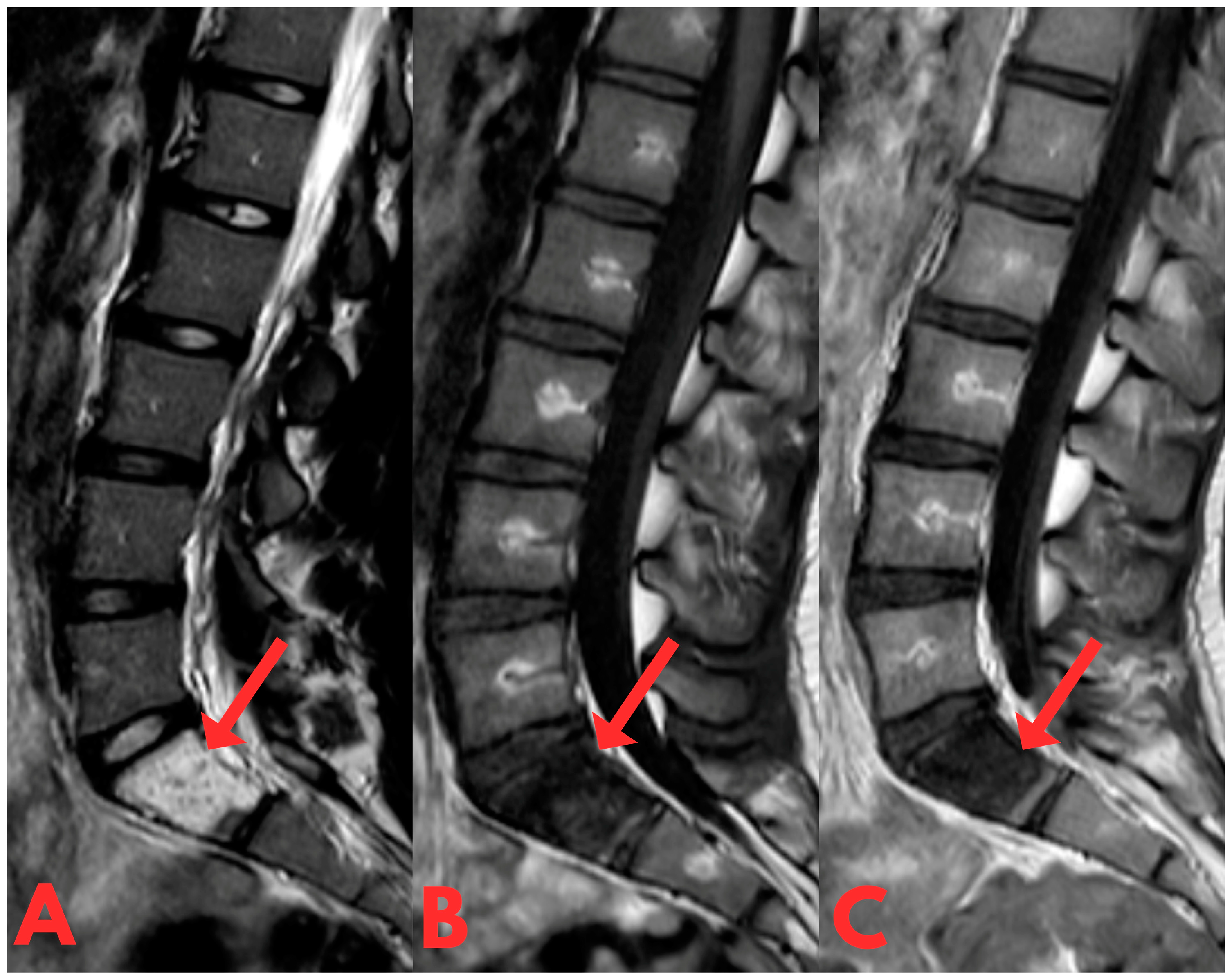 Diagnostics 14 01330 g002