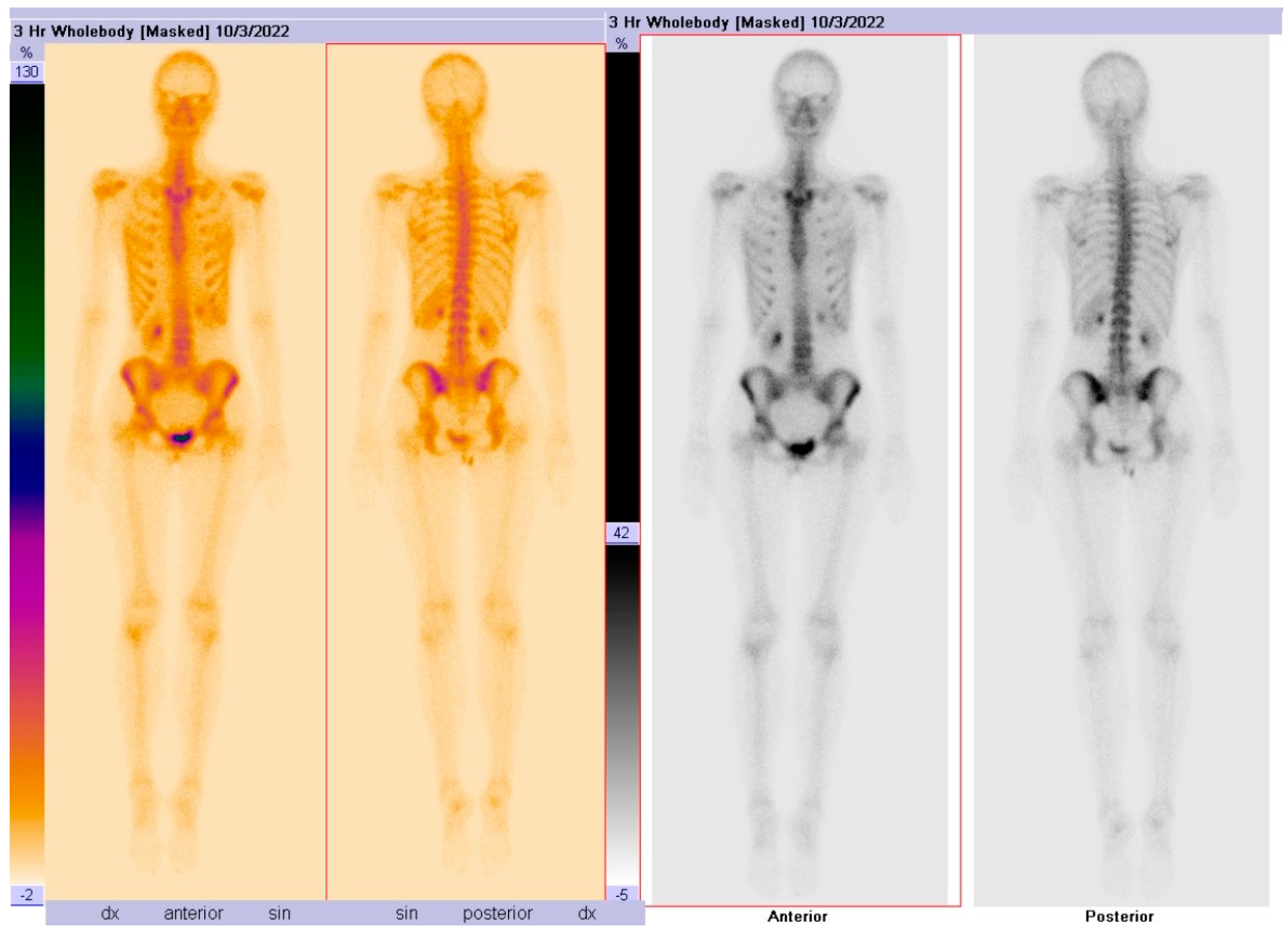 Diagnostics 14 01330 g003