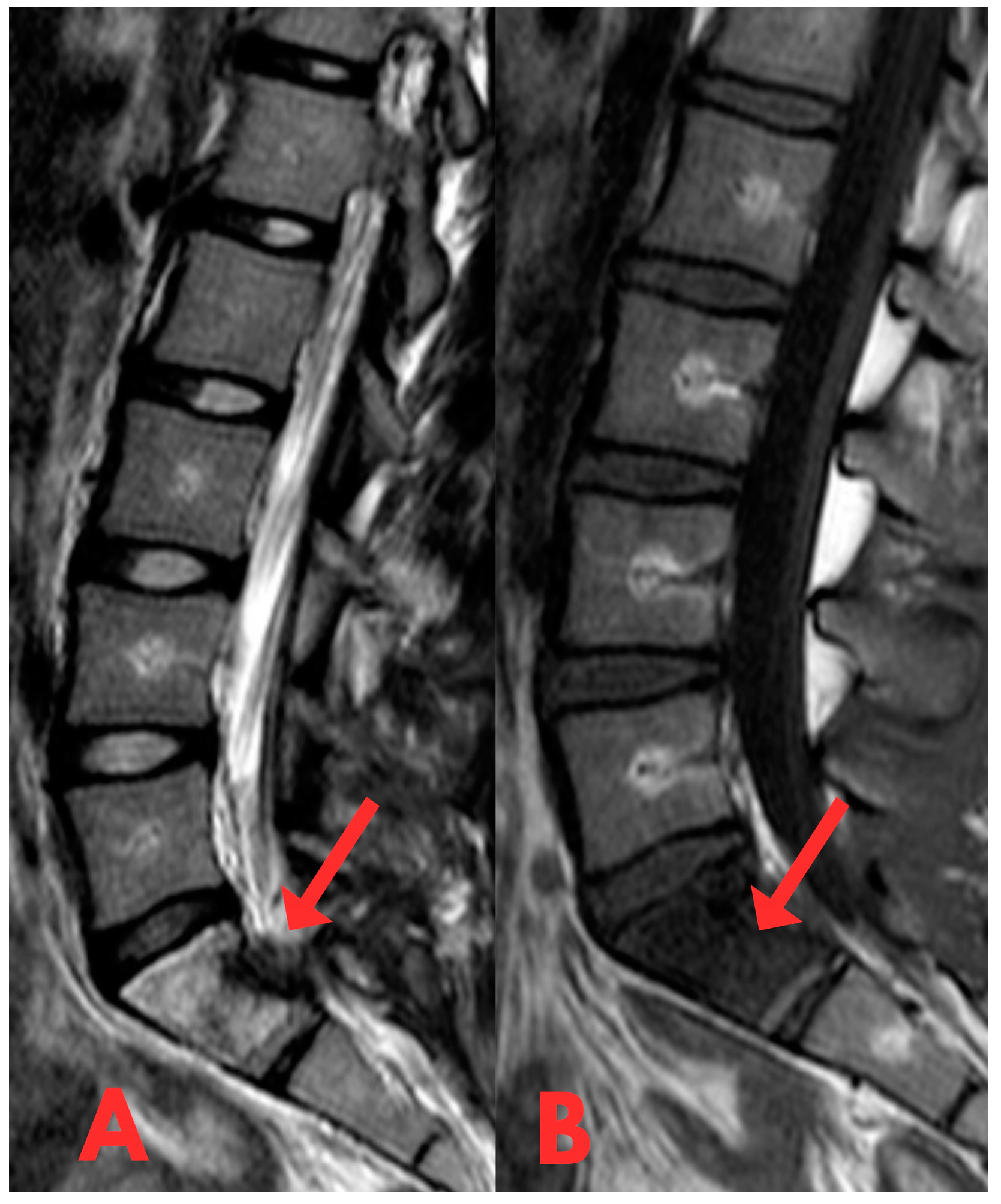 Diagnostics 14 01330 g004