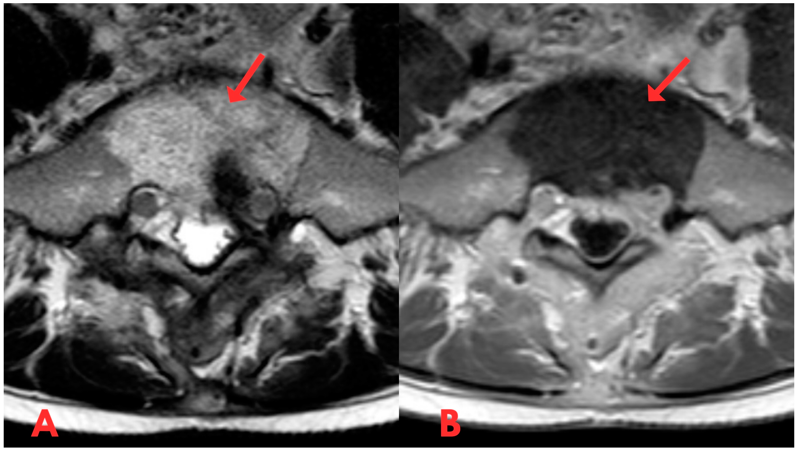 Diagnostics 14 01330 g005