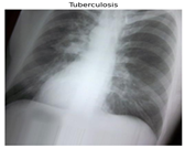 Diagnostics 14 01334 i001