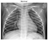 Diagnostics 14 01334 i002