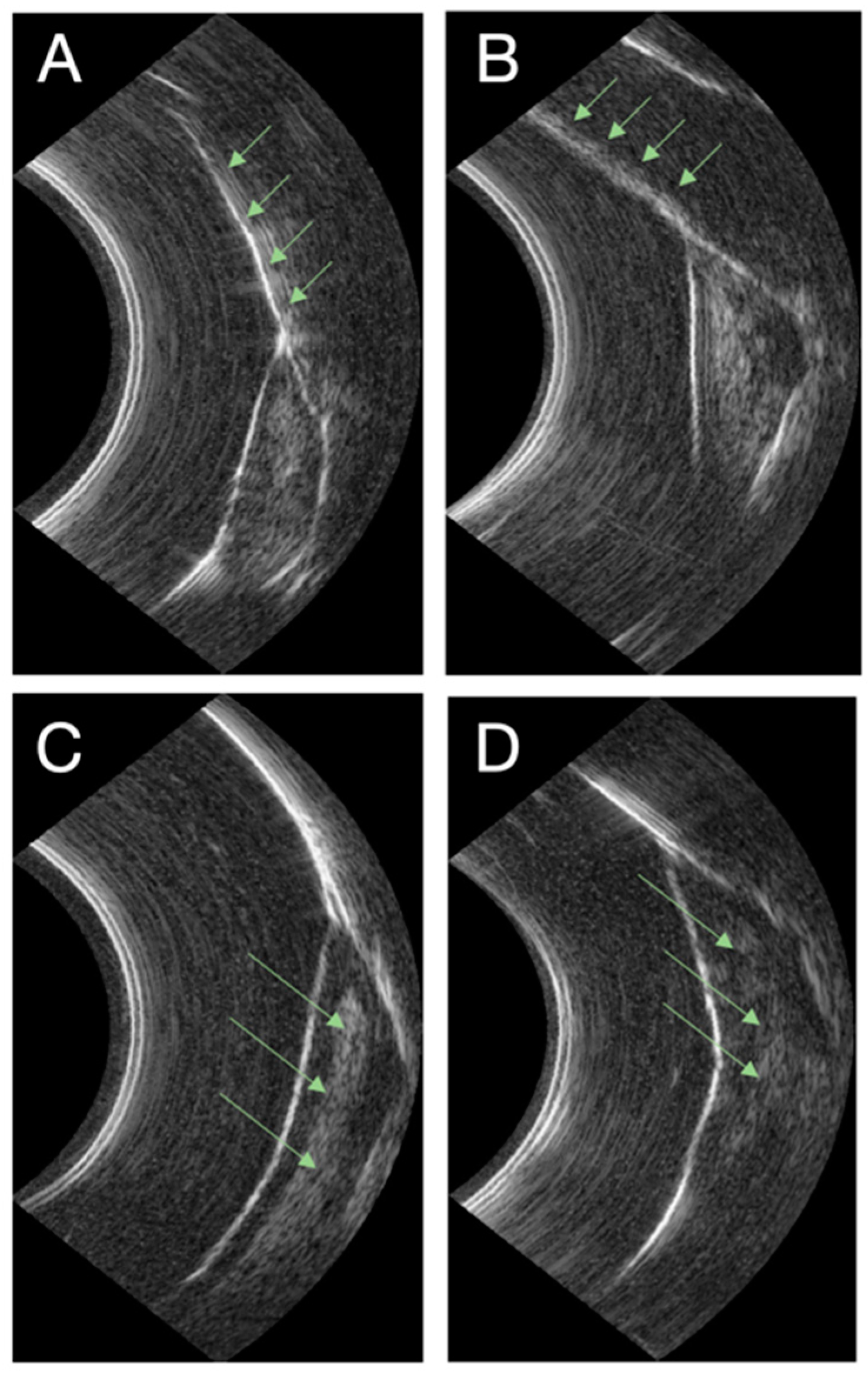 Diagnostics 14 01335 g005