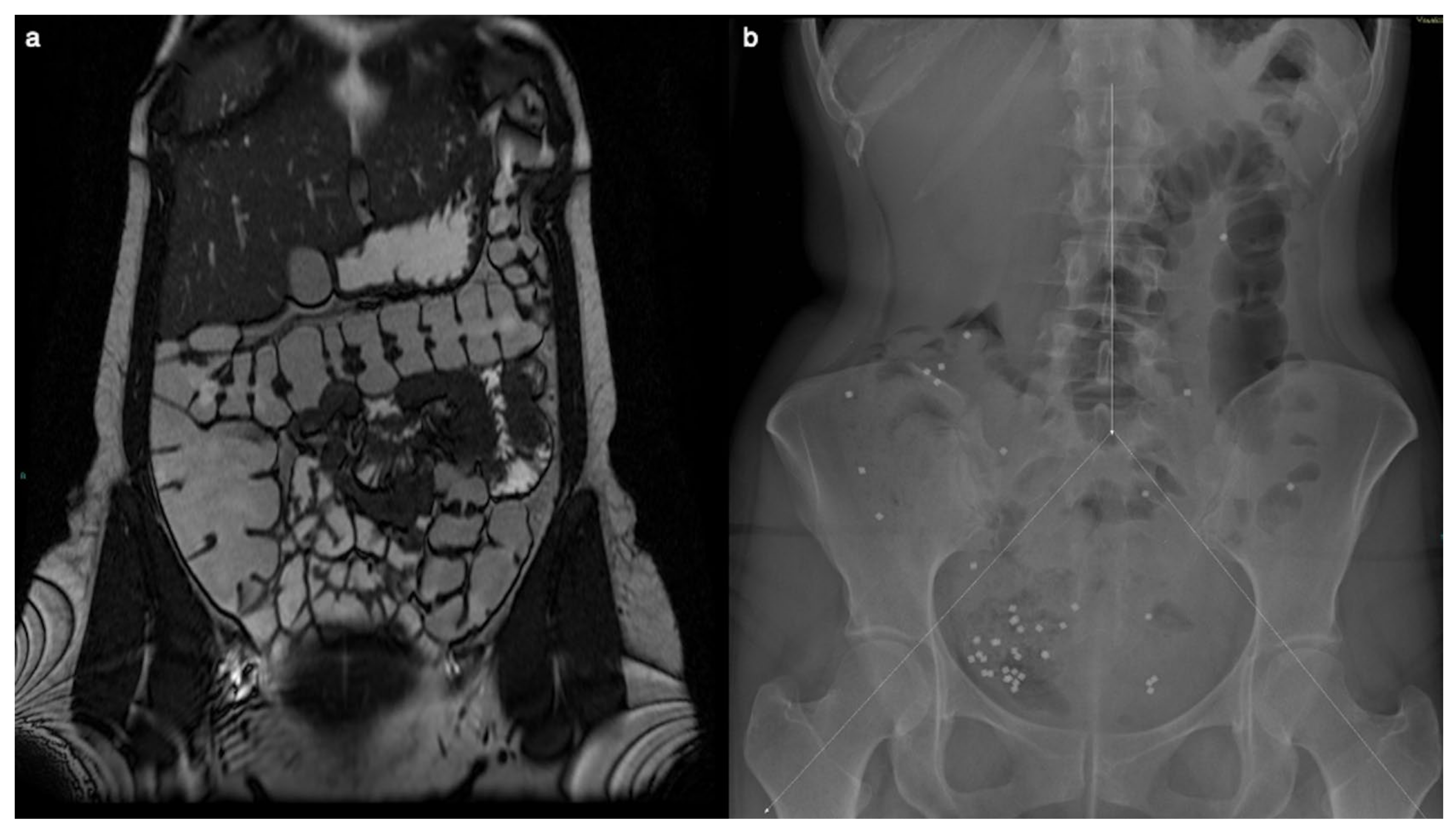 Diagnostics 14 01337 g001