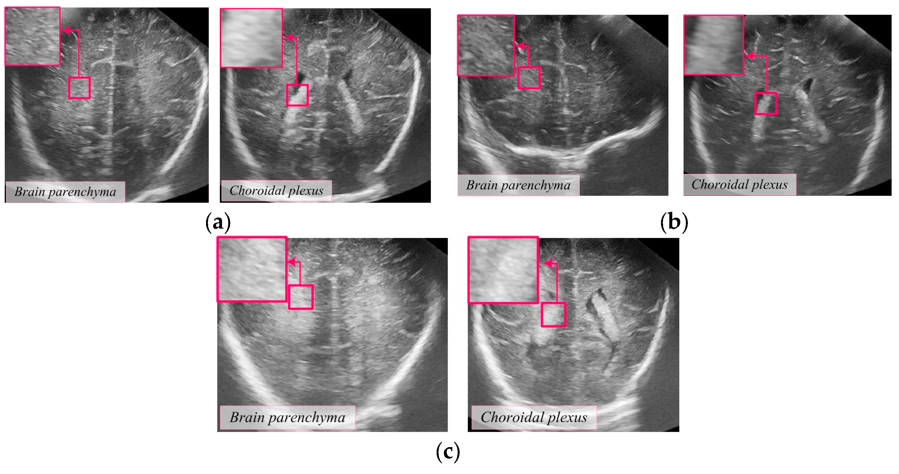 Diagnostics 14 01342 g001