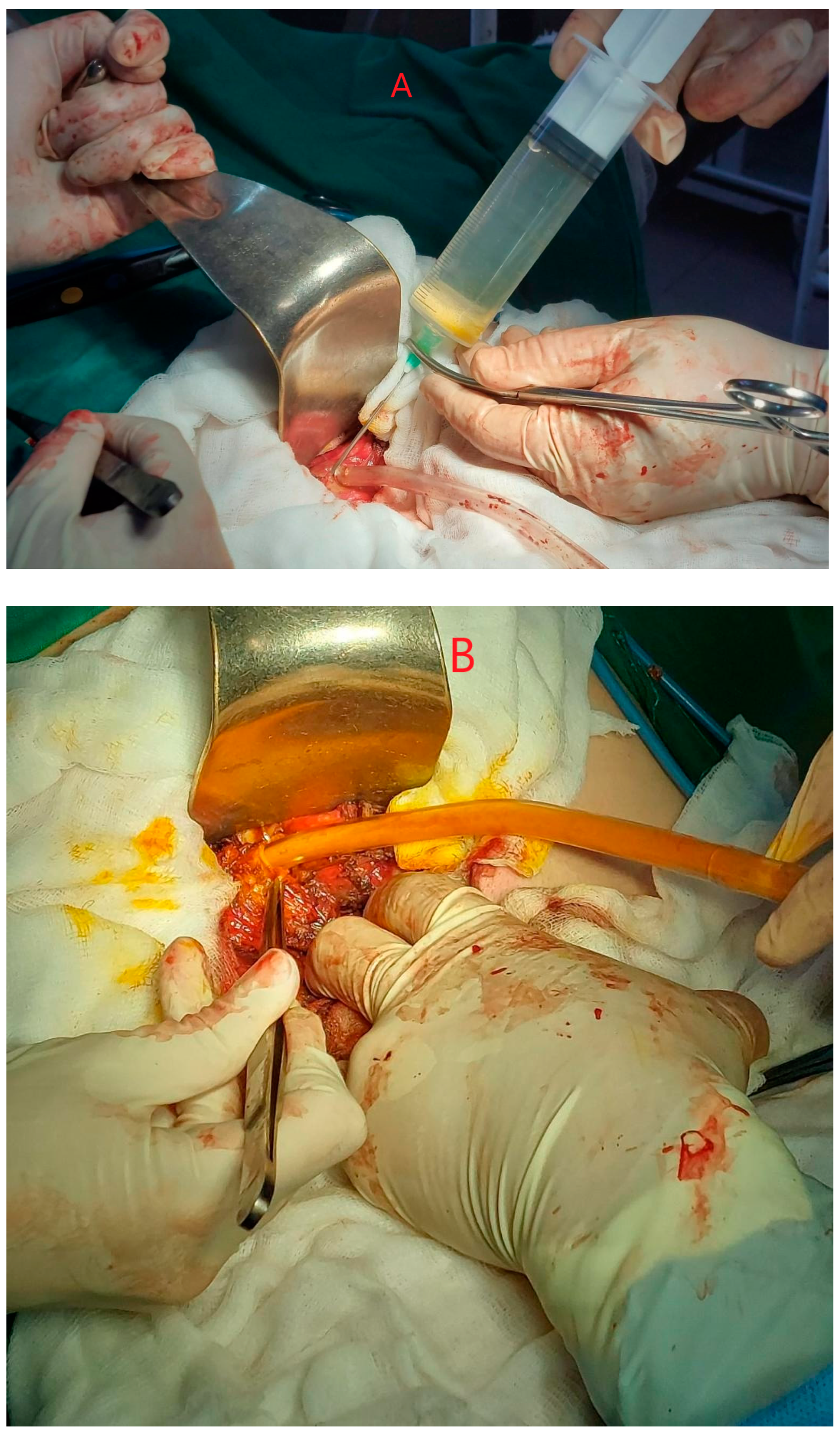 Diagnostics 14 01346 g001 Diagnostics 14 01346 g001