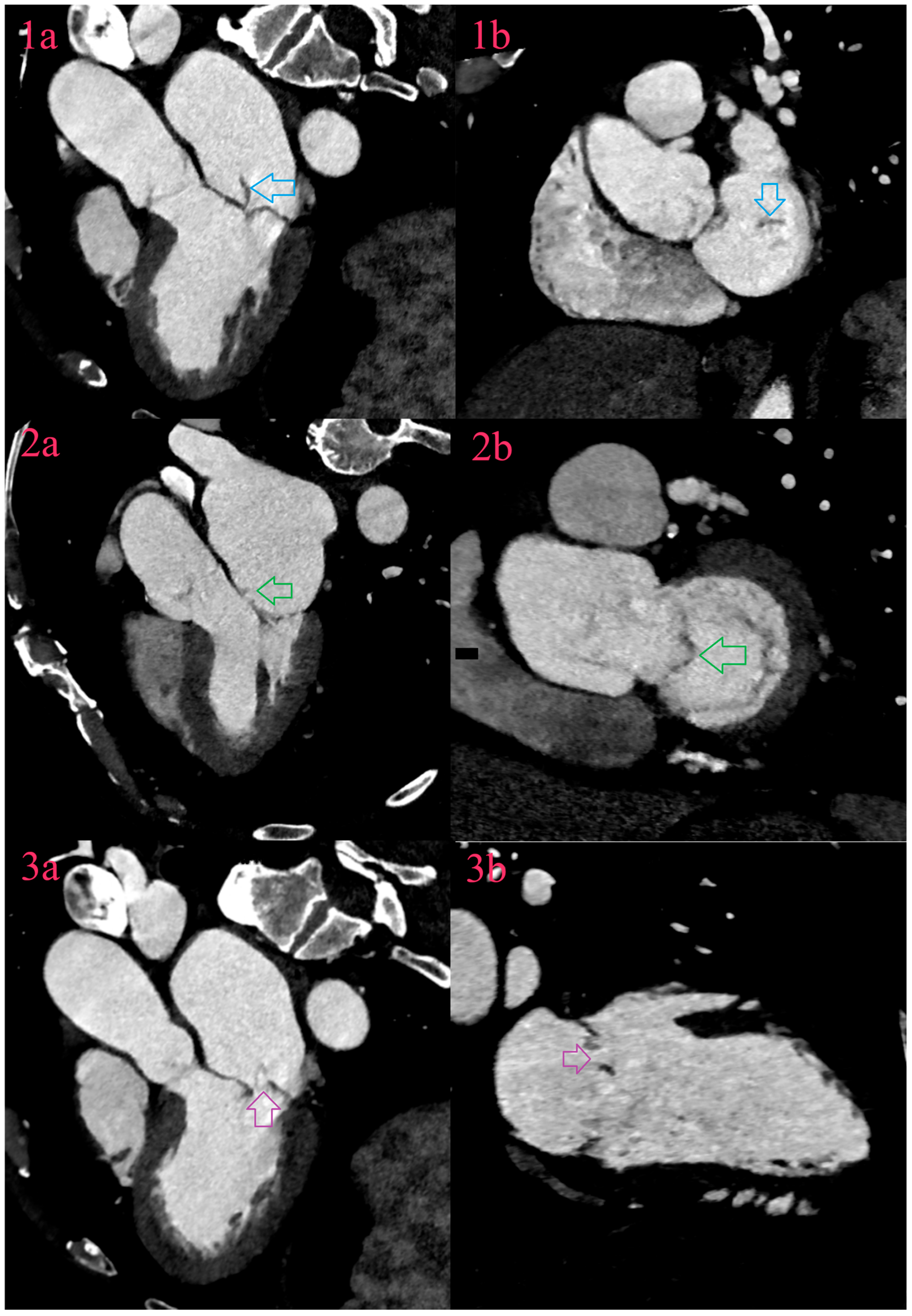 Diagnostics 14 01355 g003 Diagnostics 14 01355 g003
