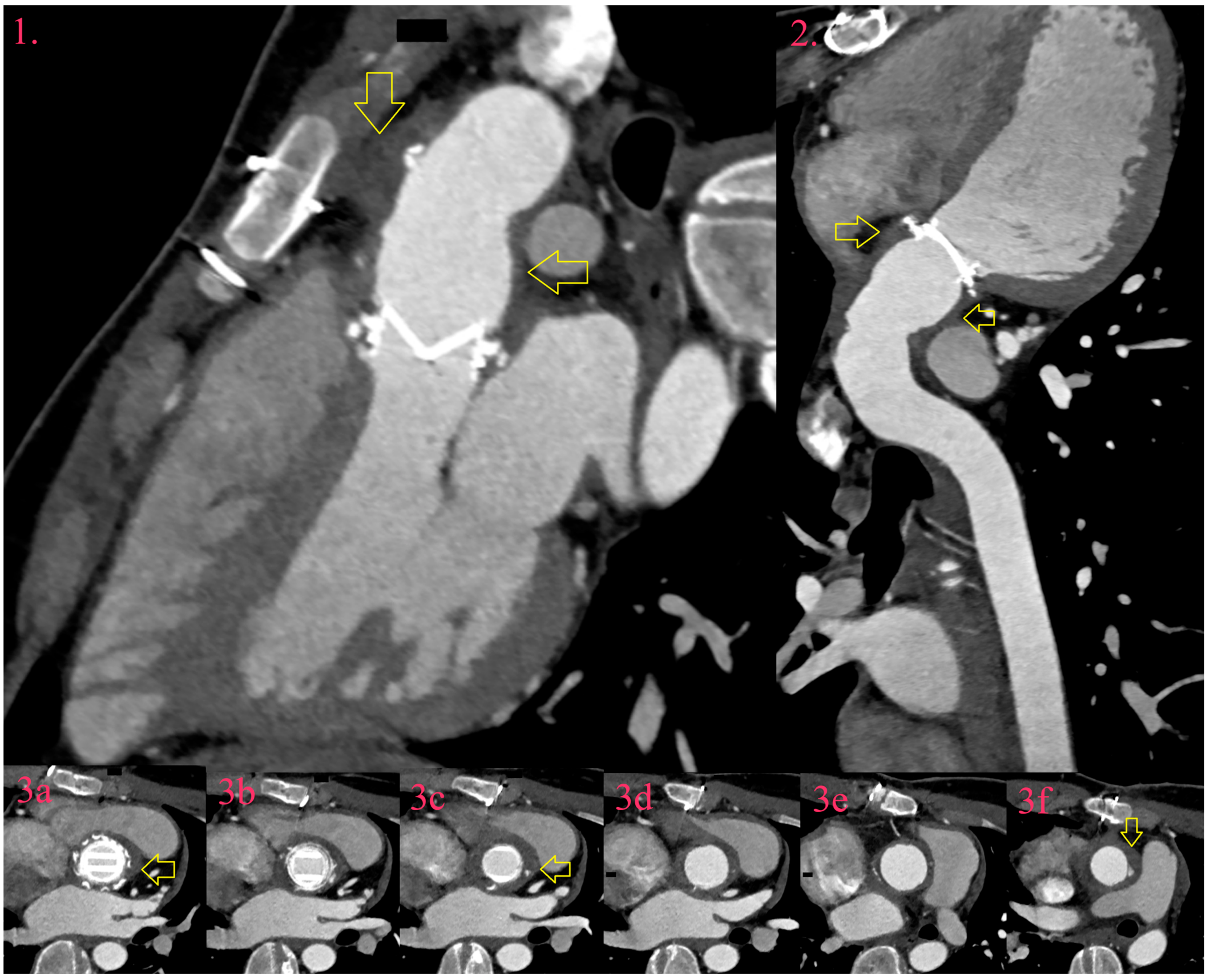 Diagnostics 14 01355 g004 Diagnostics 14 01355 g004