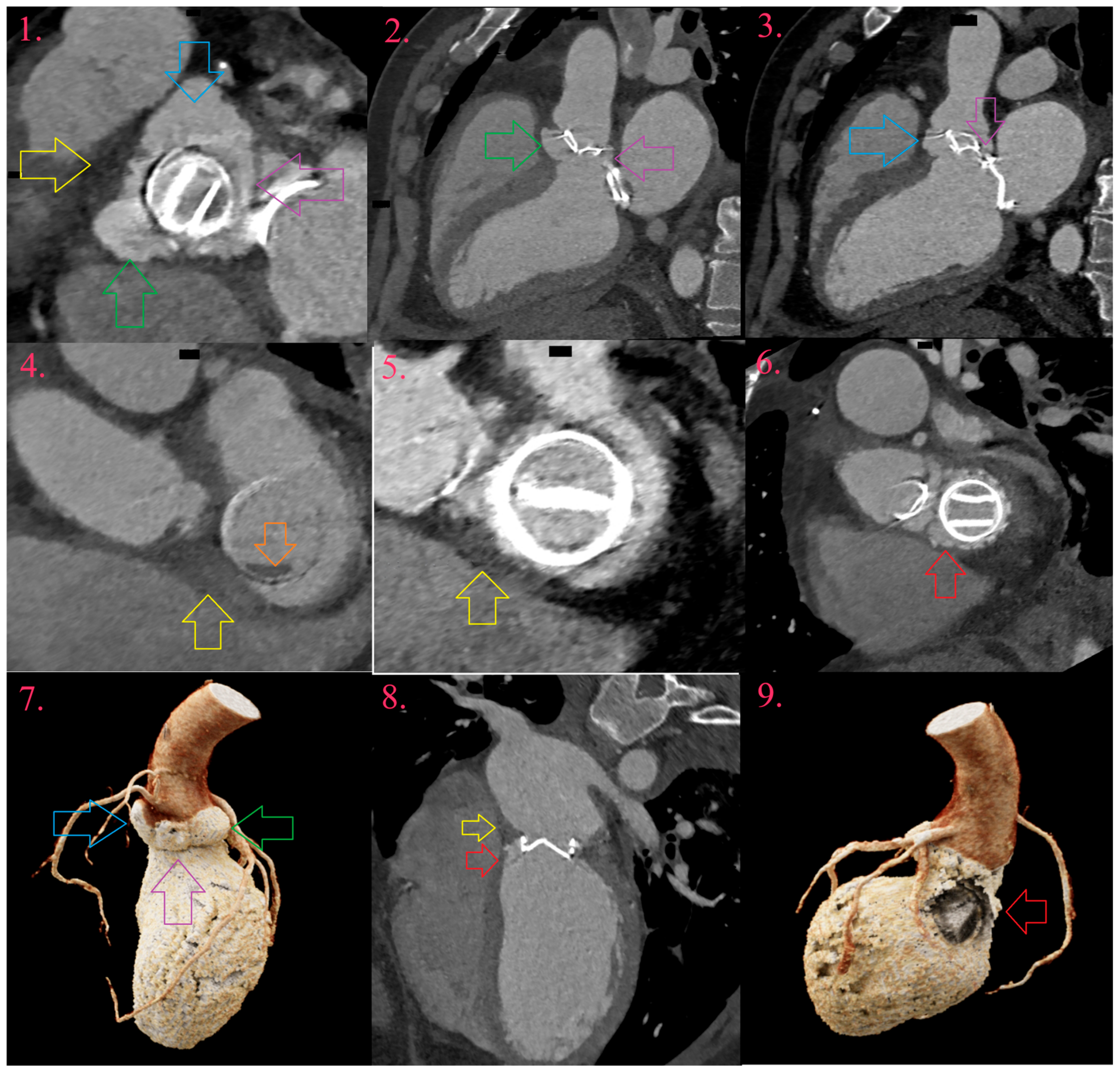 Diagnostics 14 01355 g005 Diagnostics 14 01355 g005
