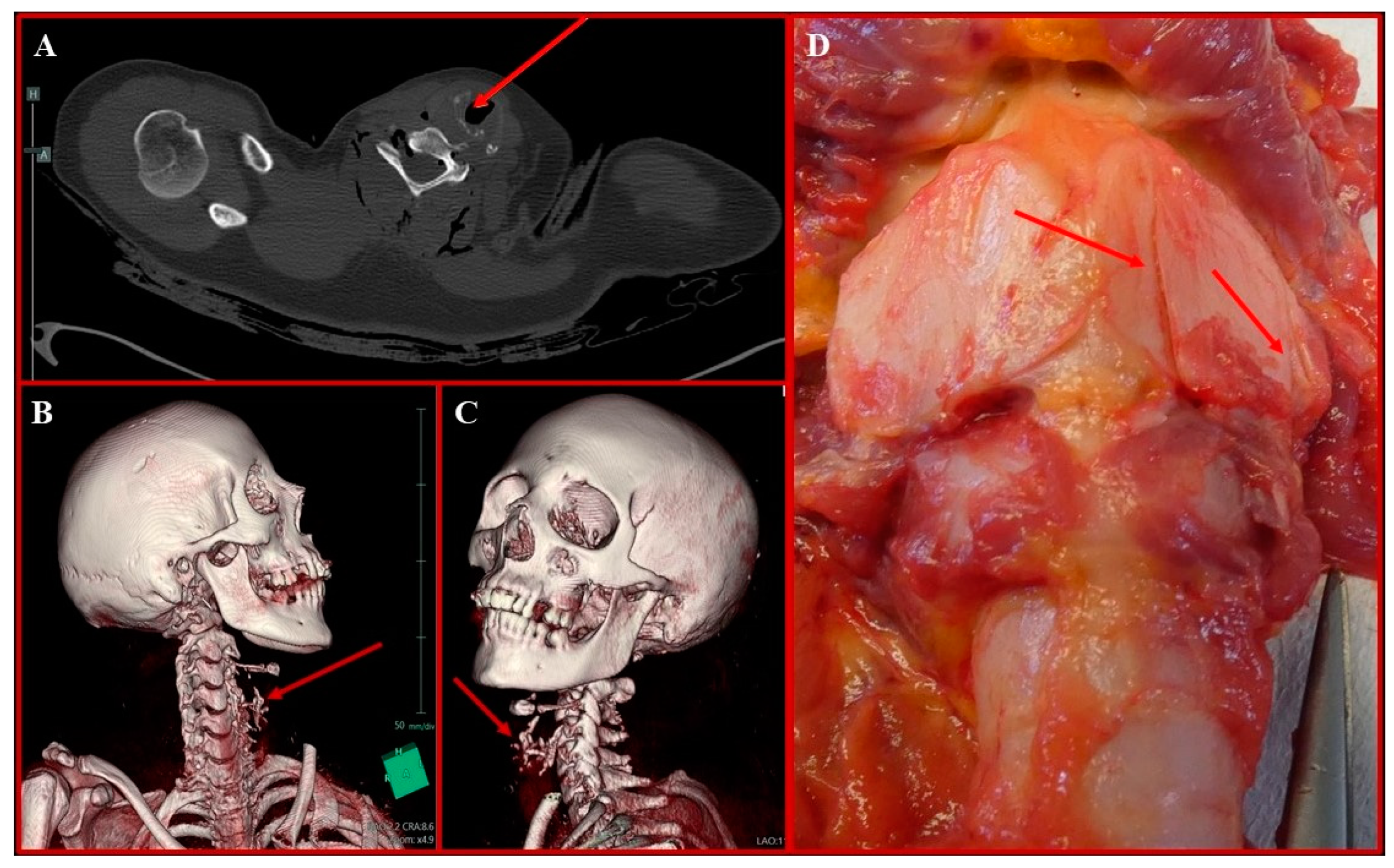 Diagnostics 14 01360 g002