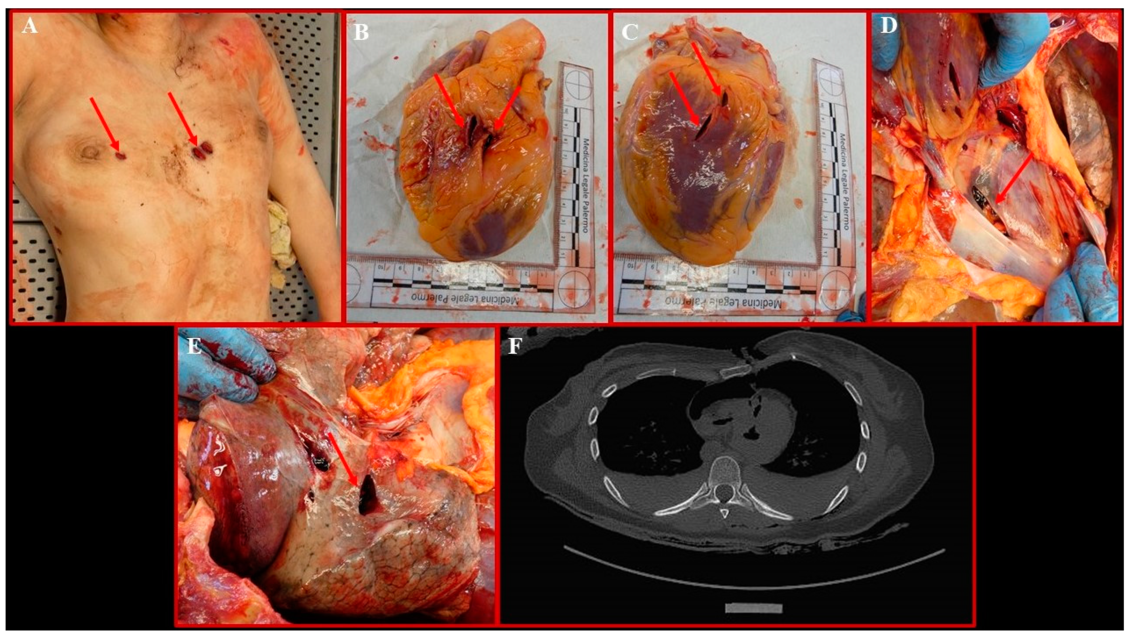 Diagnostics 14 01360 g003