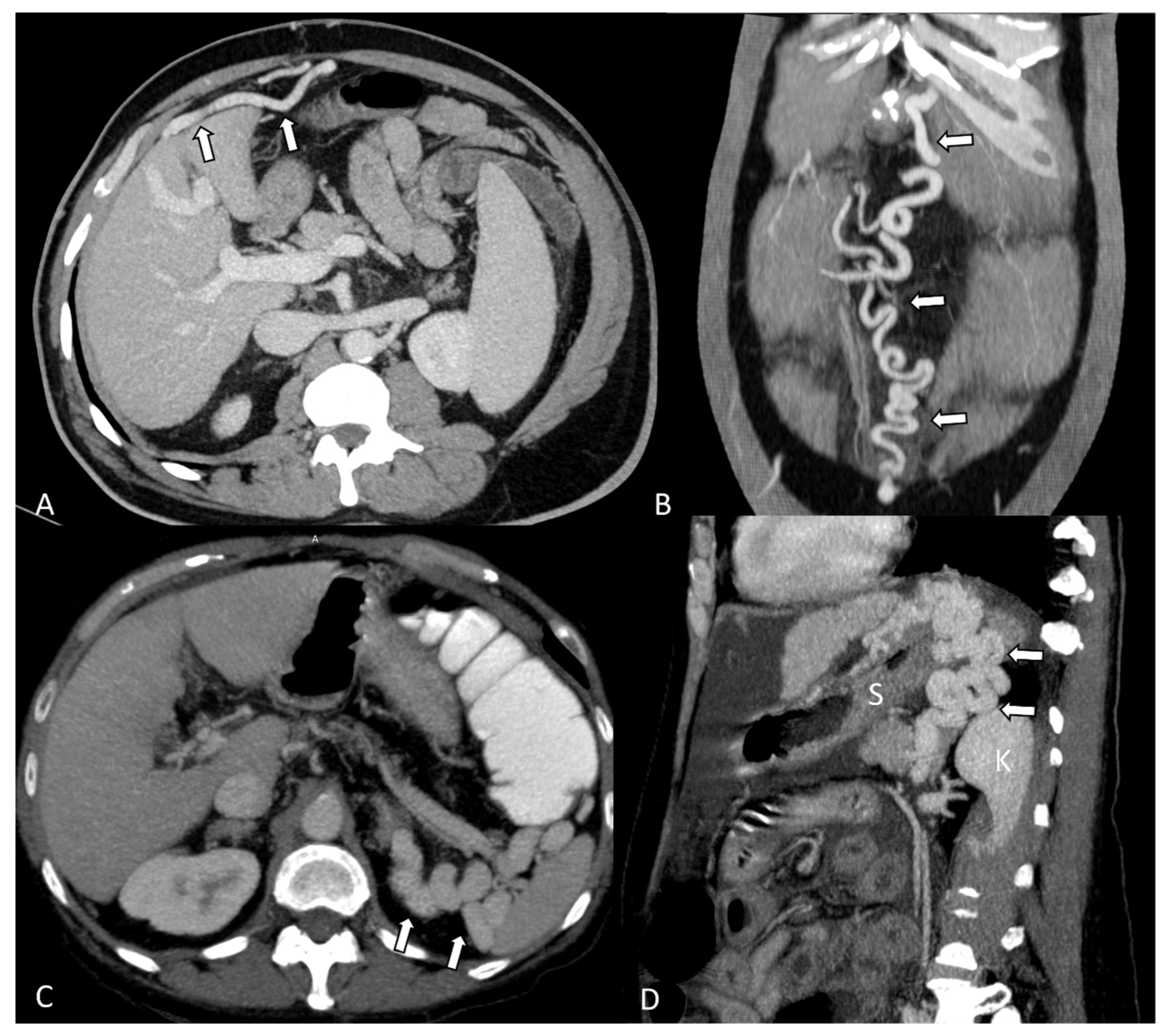 Diagnostics 14 01372 g002