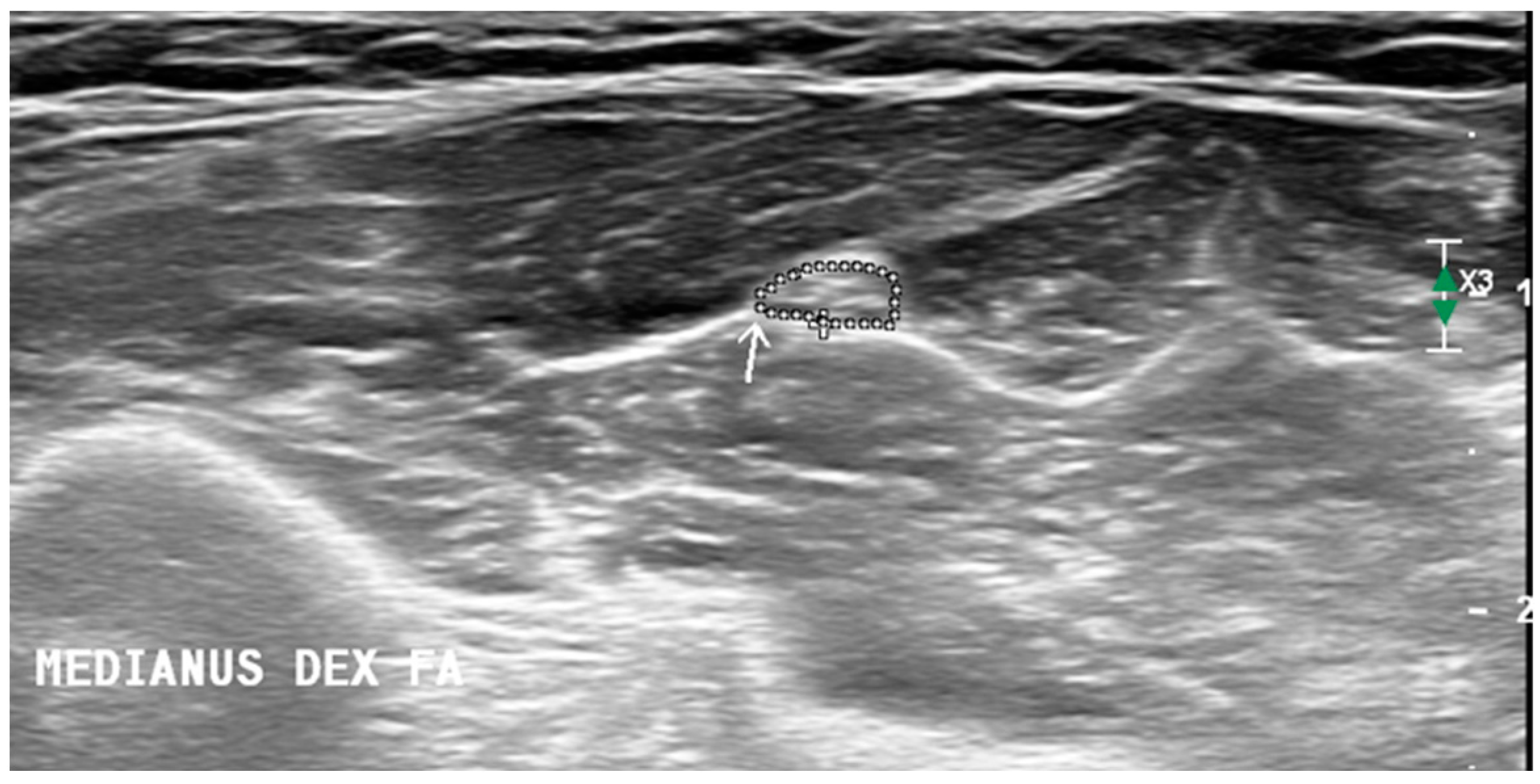 Diagnostics 14 01373 g001