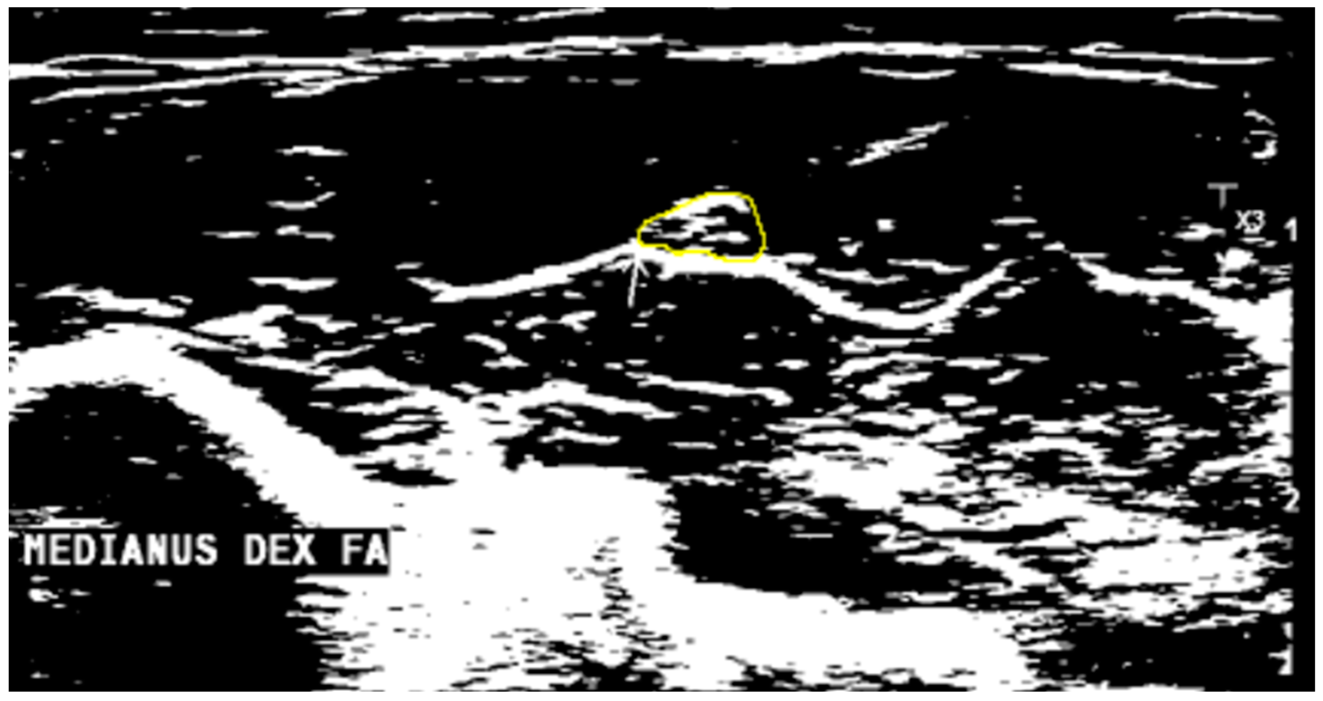 Diagnostics 14 01373 g002
