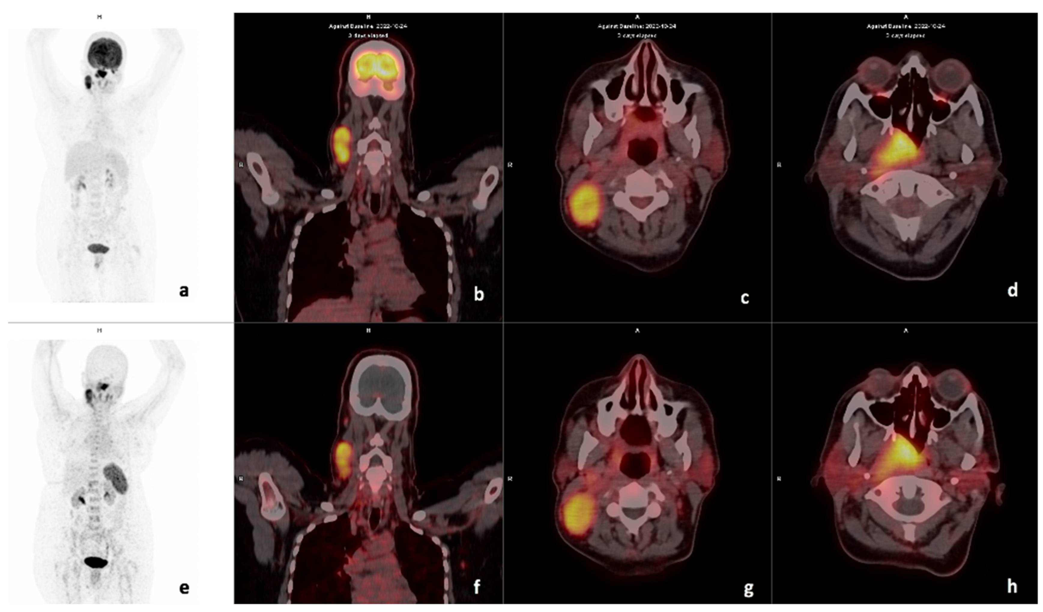 Diagnostics 14 01375 g003