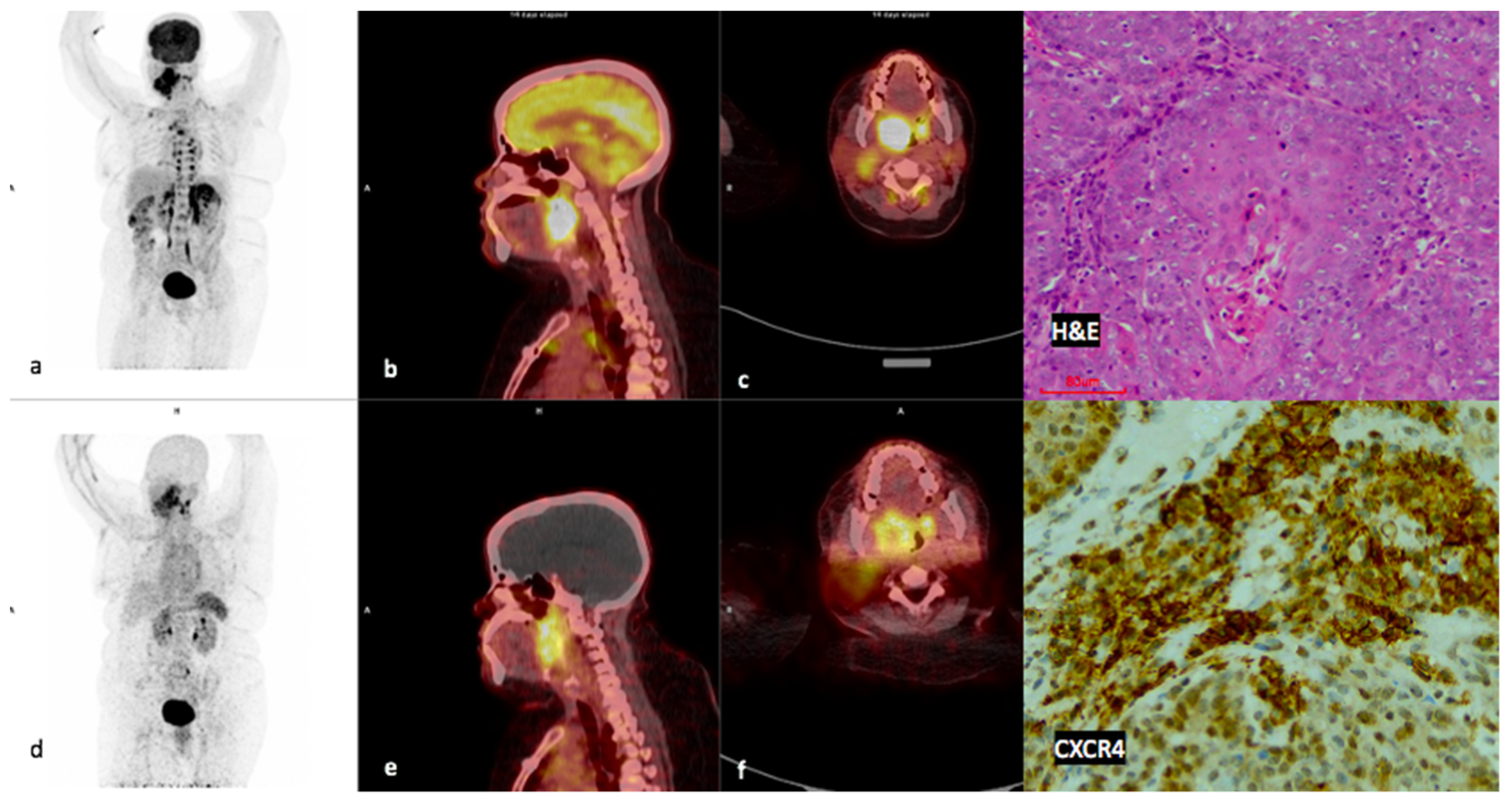 Diagnostics 14 01375 g004
