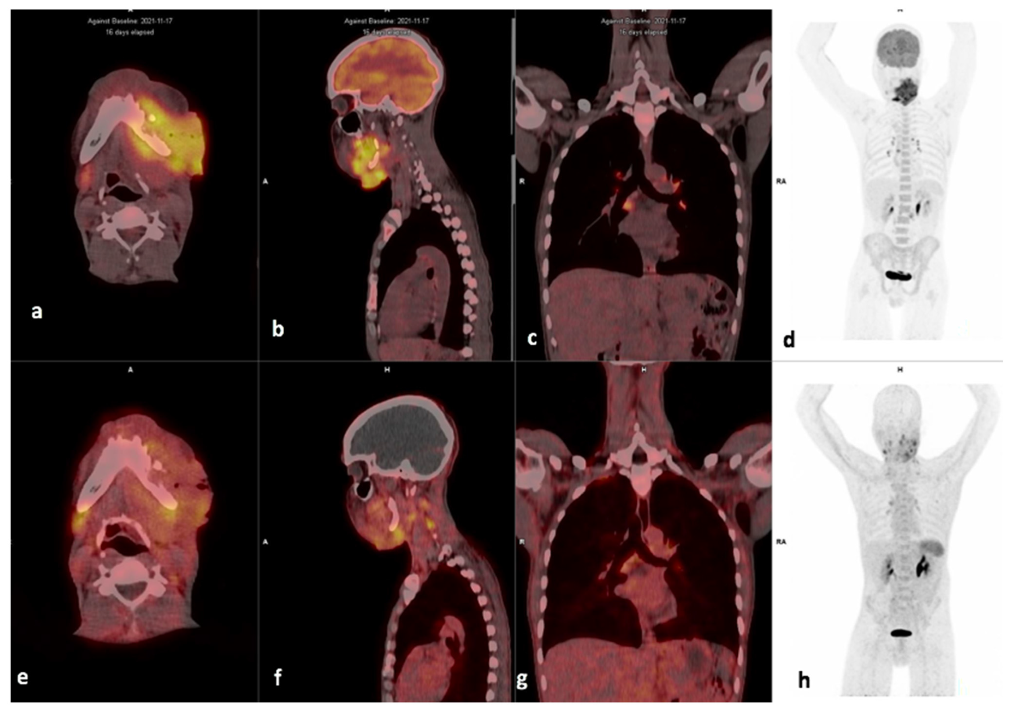 Diagnostics 14 01375 g005