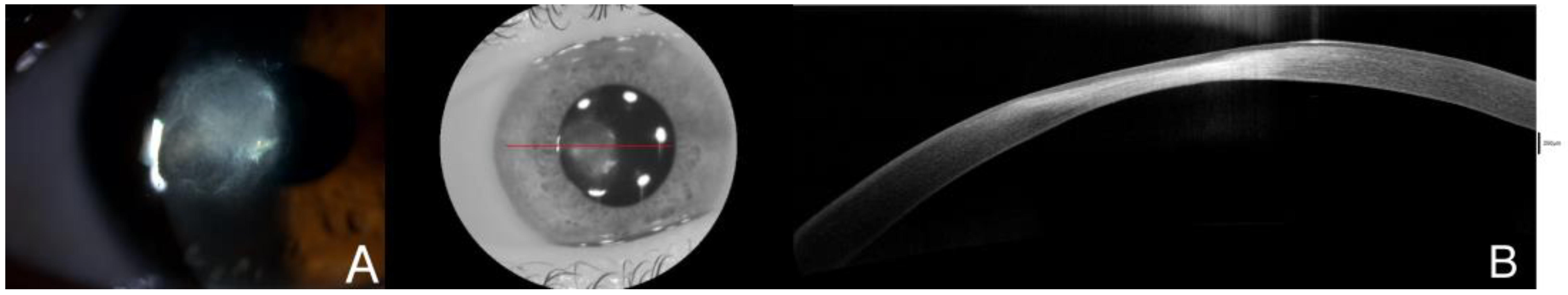 Diagnostics 14 01382 g004