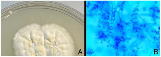Diagnostics 14 01382 g005