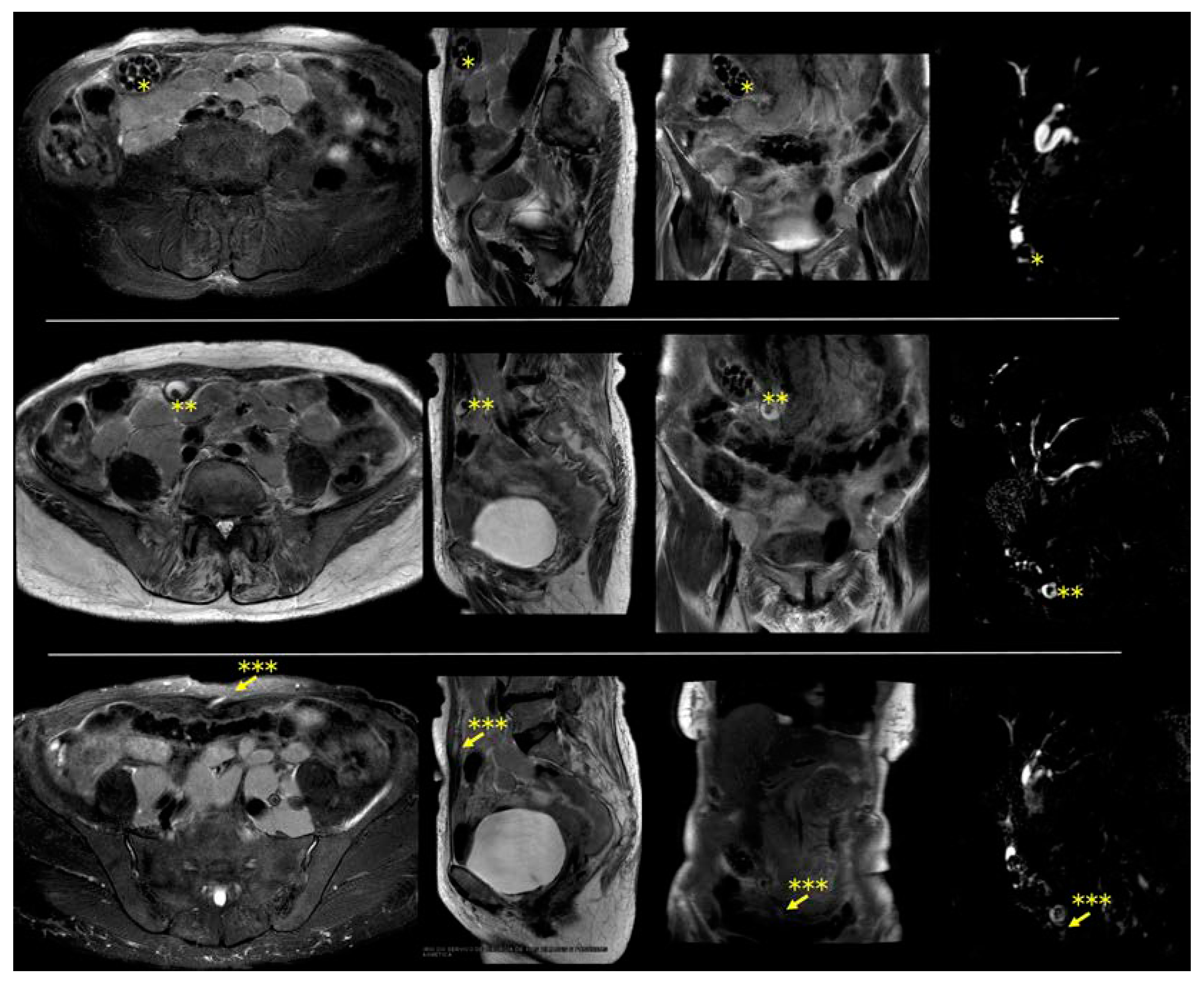 Diagnostics 14 01386 g001