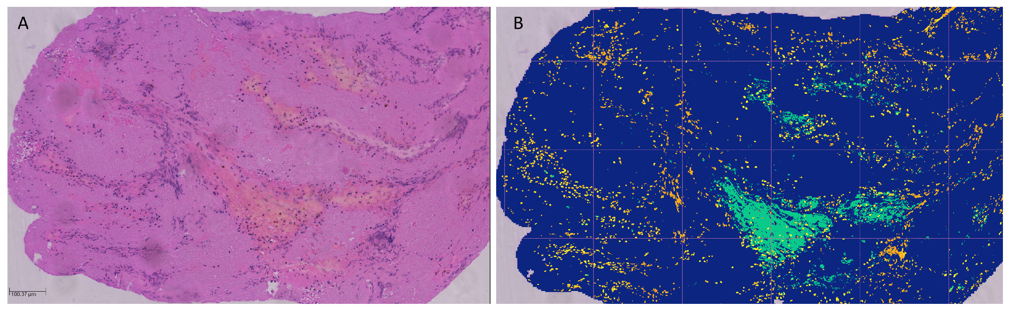 Diagnostics 14 01387 g002