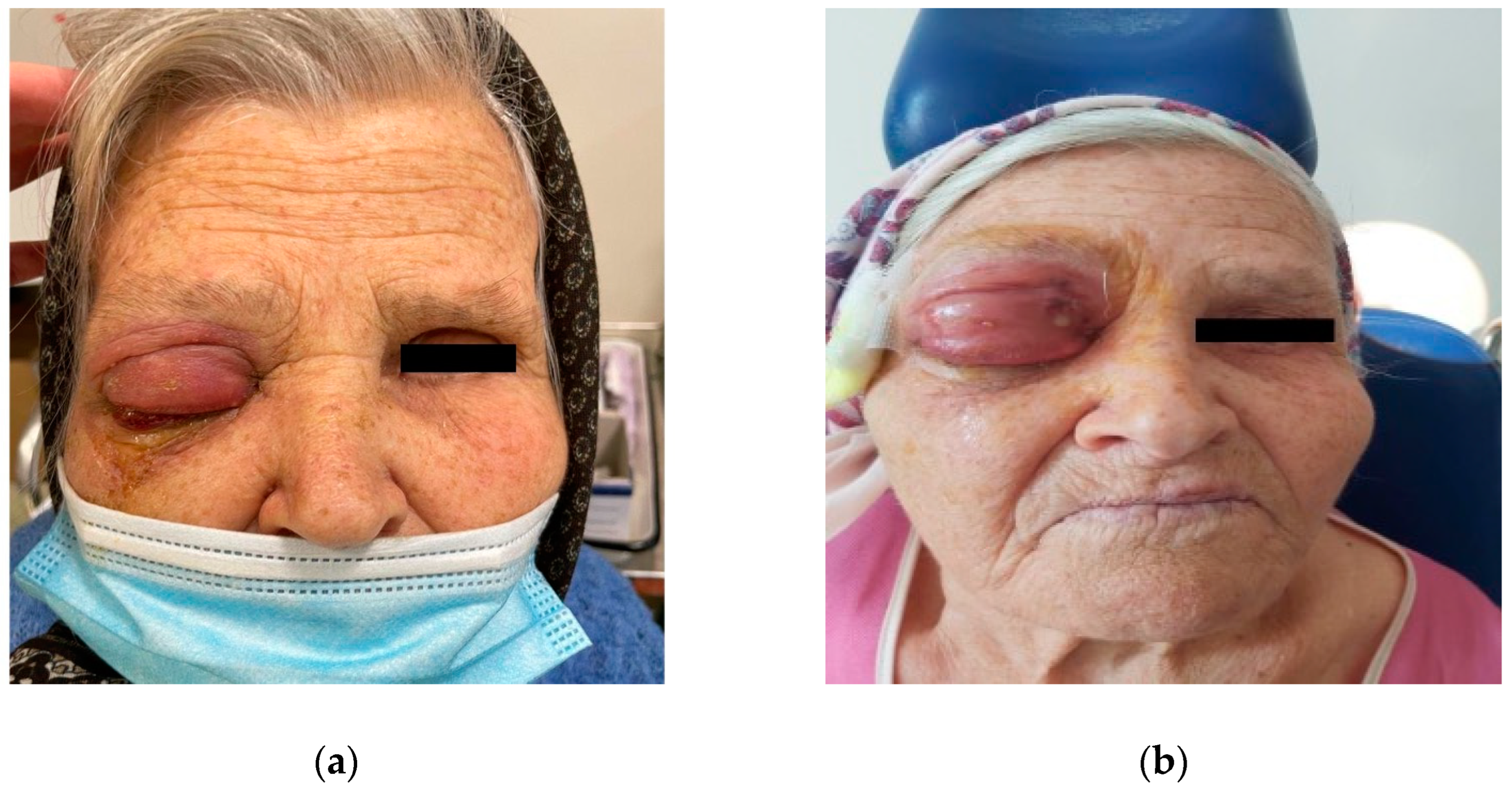 Diagnostics 14 01391 g001