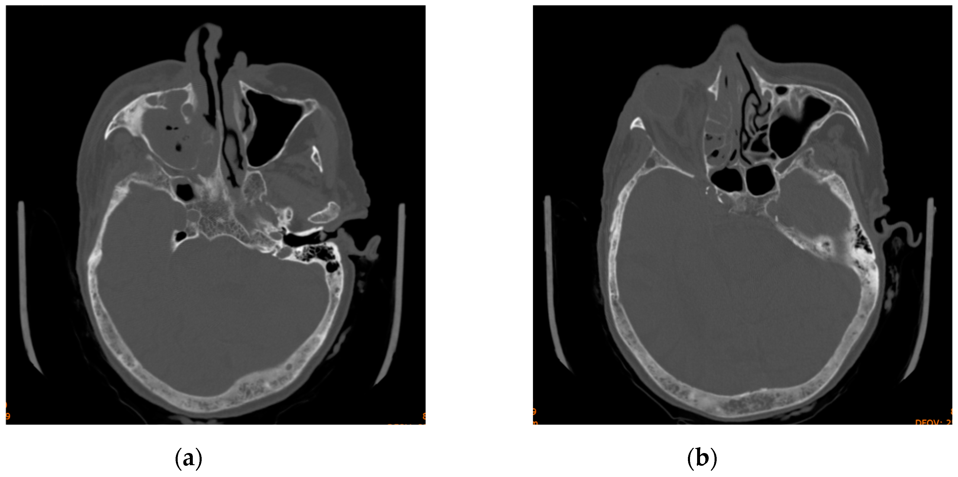 Diagnostics 14 01391 g002
