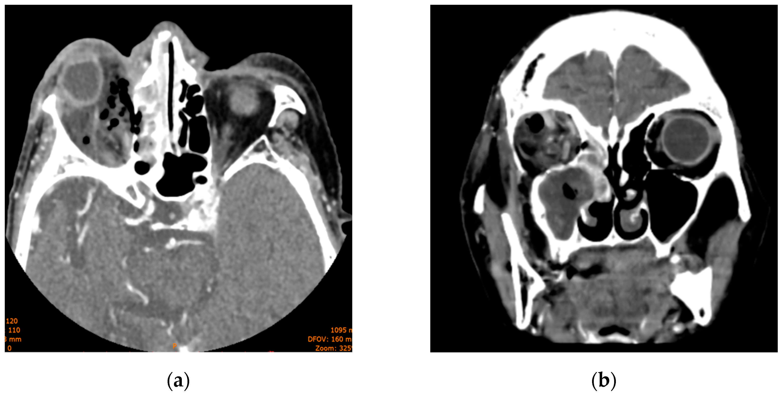 Diagnostics 14 01391 g003
