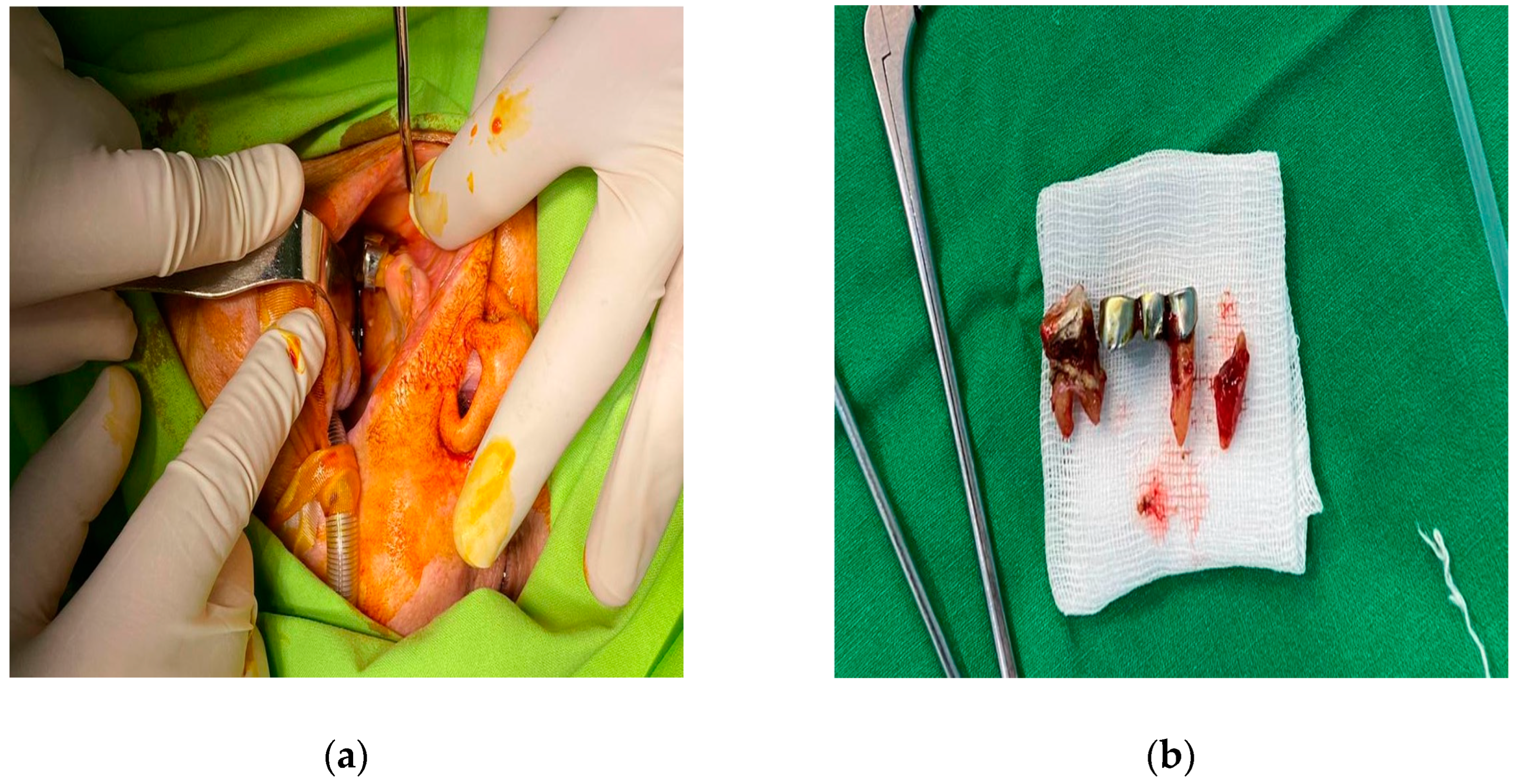 Diagnostics 14 01391 g004