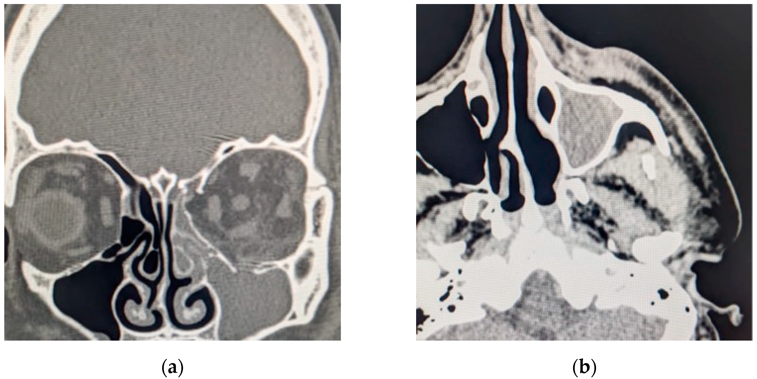 Diagnostics 14 01391 g010