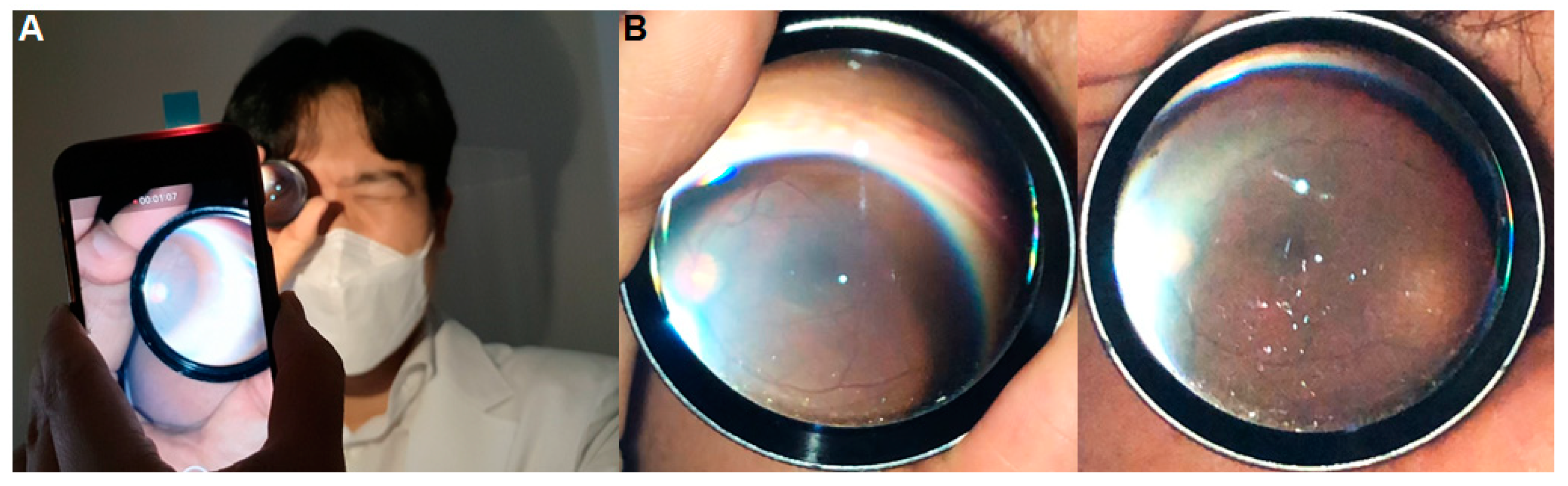 Diagnostics 14 01395 g004