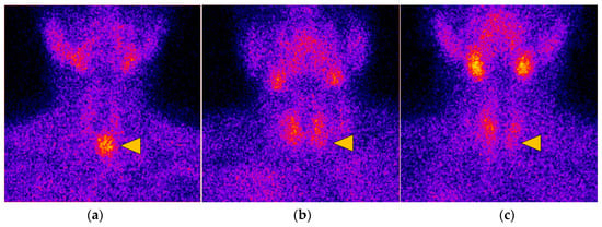Diagnostics 14 01398 g002