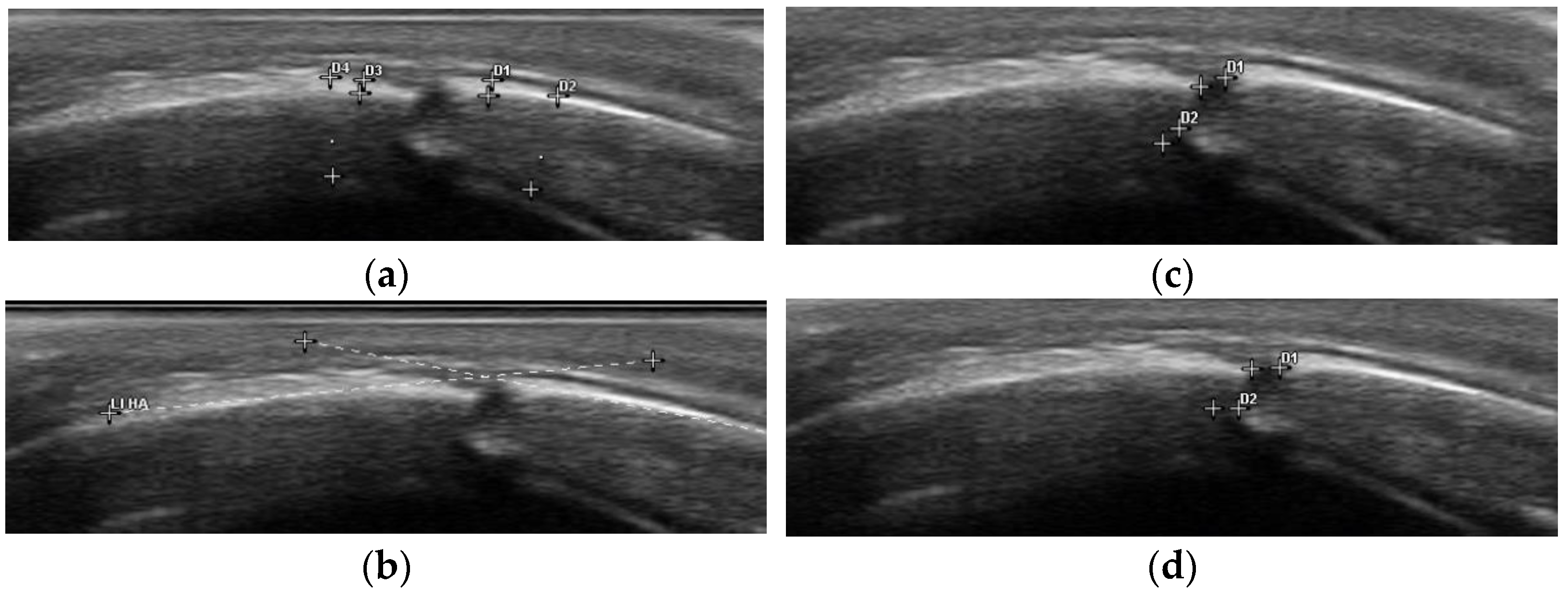 Diagnostics 14 01407 g002 Diagnostics 14 01407 g002