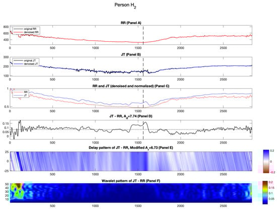 Diagnostics 14 01410 g003