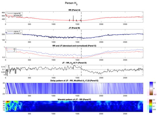 Diagnostics 14 01410 g004