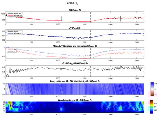 Diagnostics 14 01410 g005