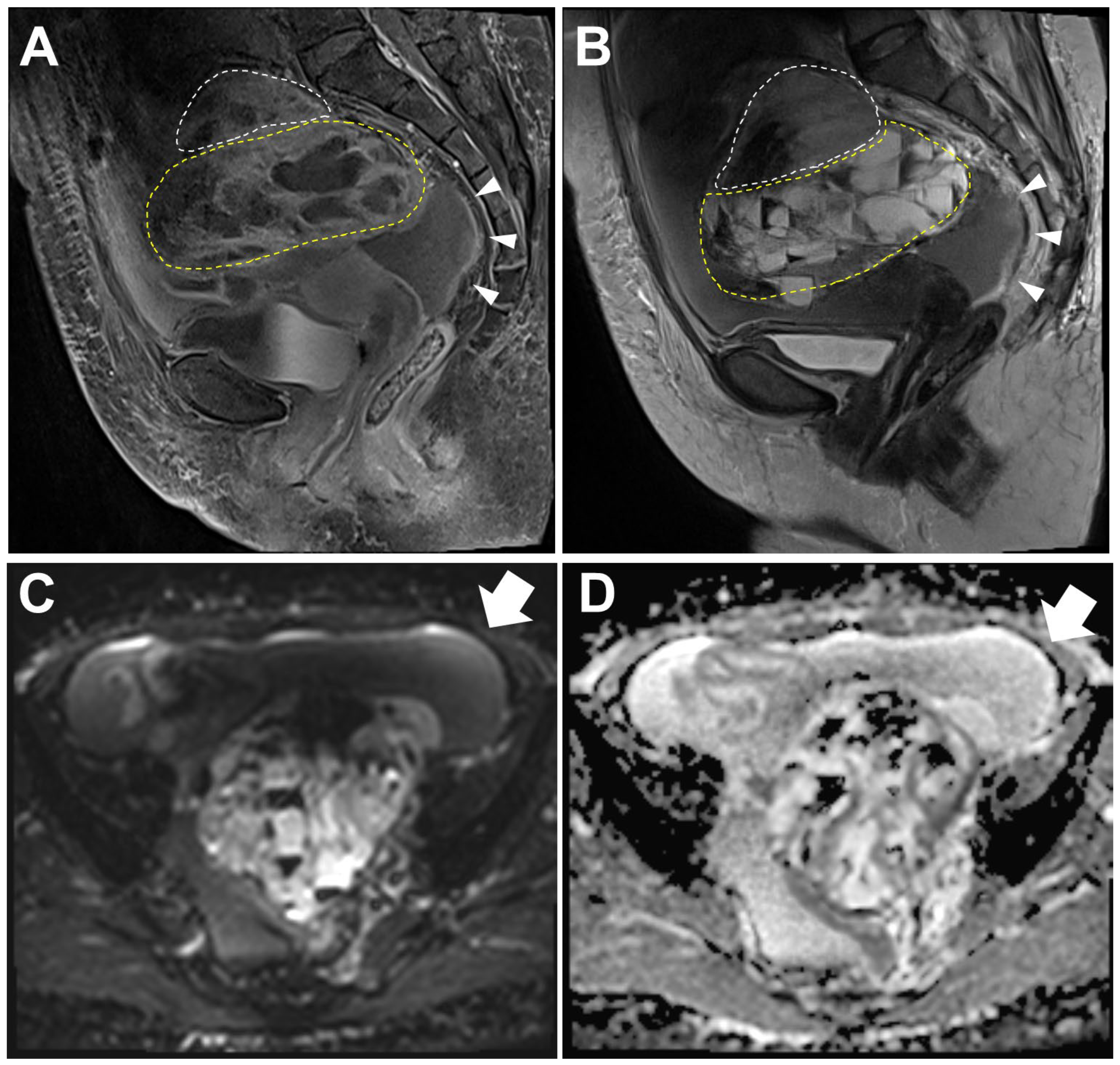 Diagnostics 14 01412 g001