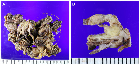 Diagnostics 14 01412 g002