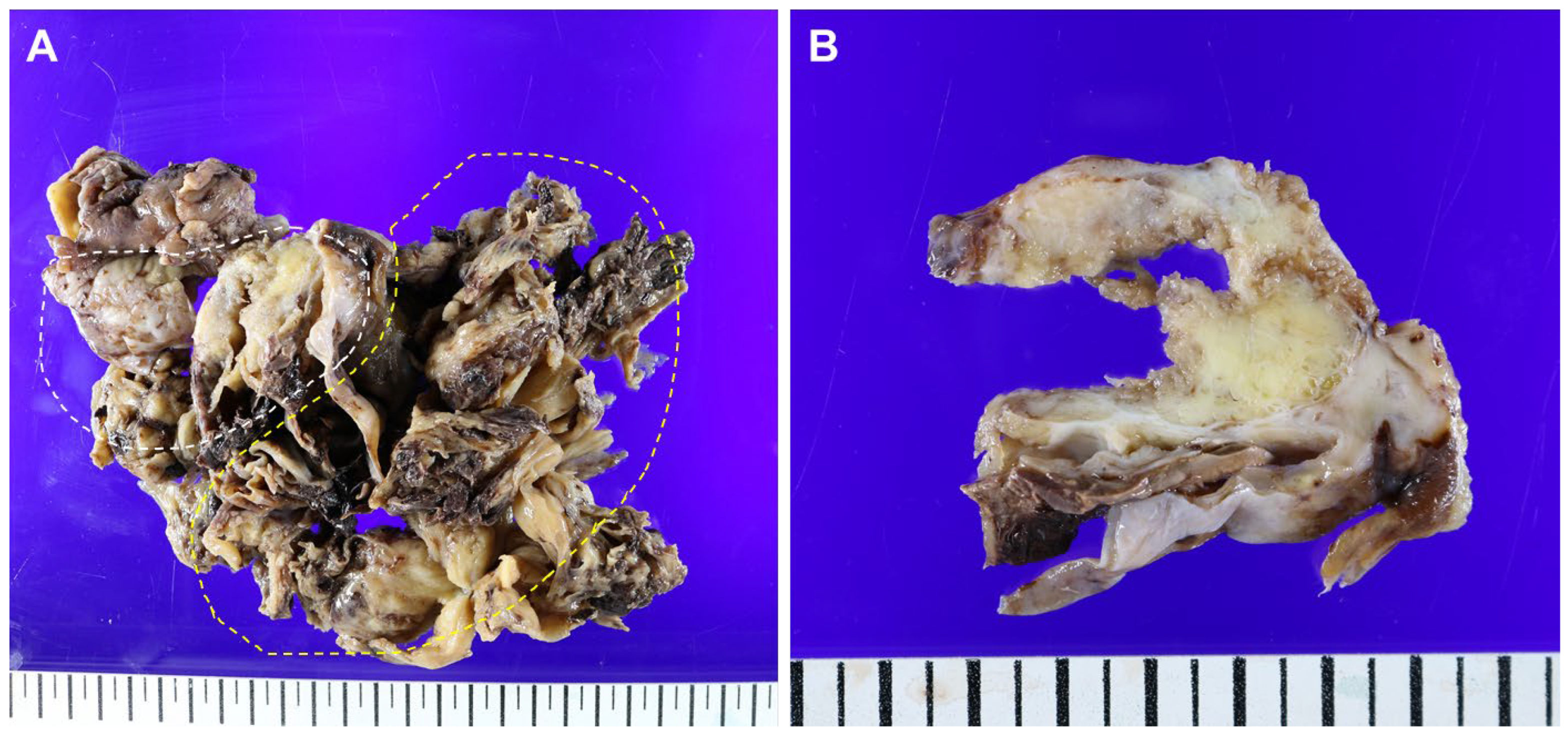 Diagnostics 14 01412 g002