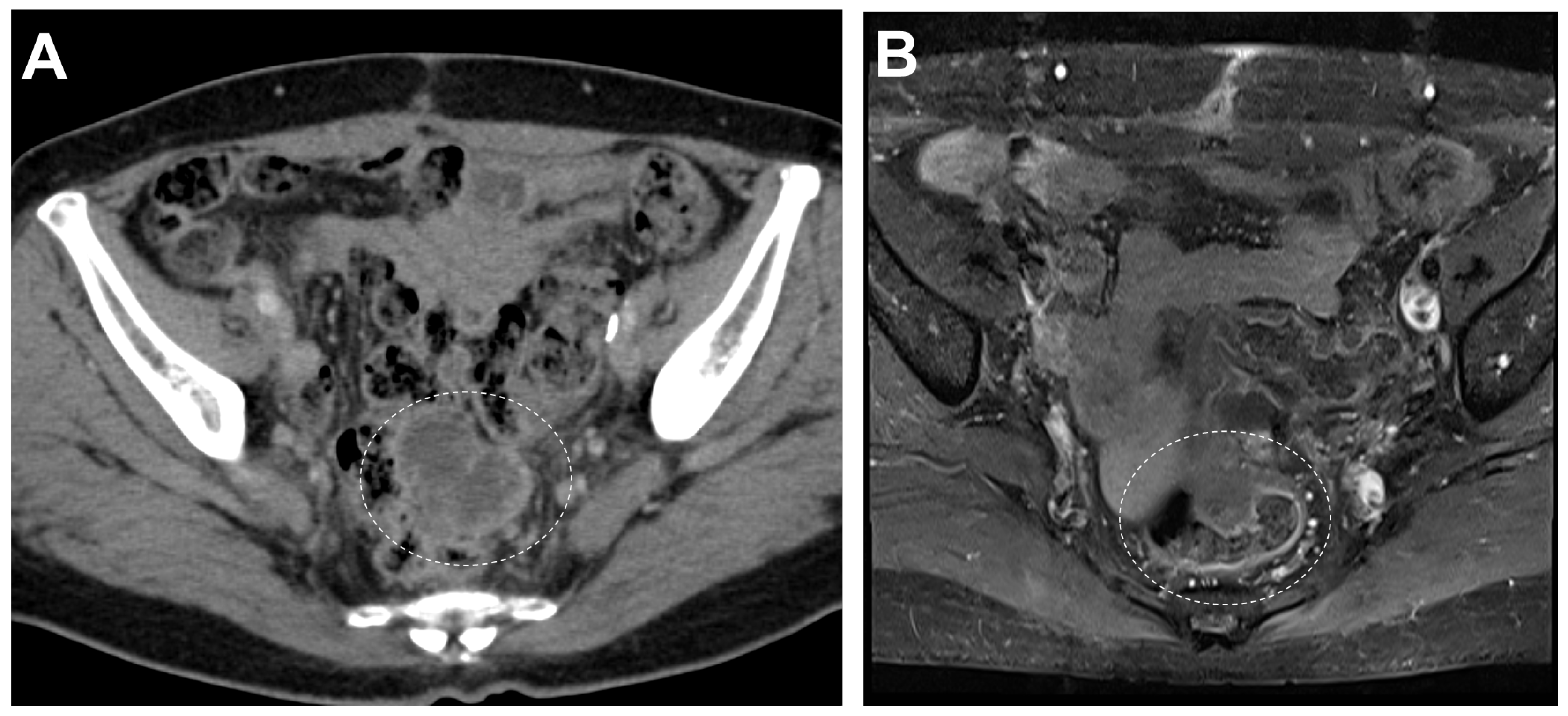 Diagnostics 14 01412 g004
