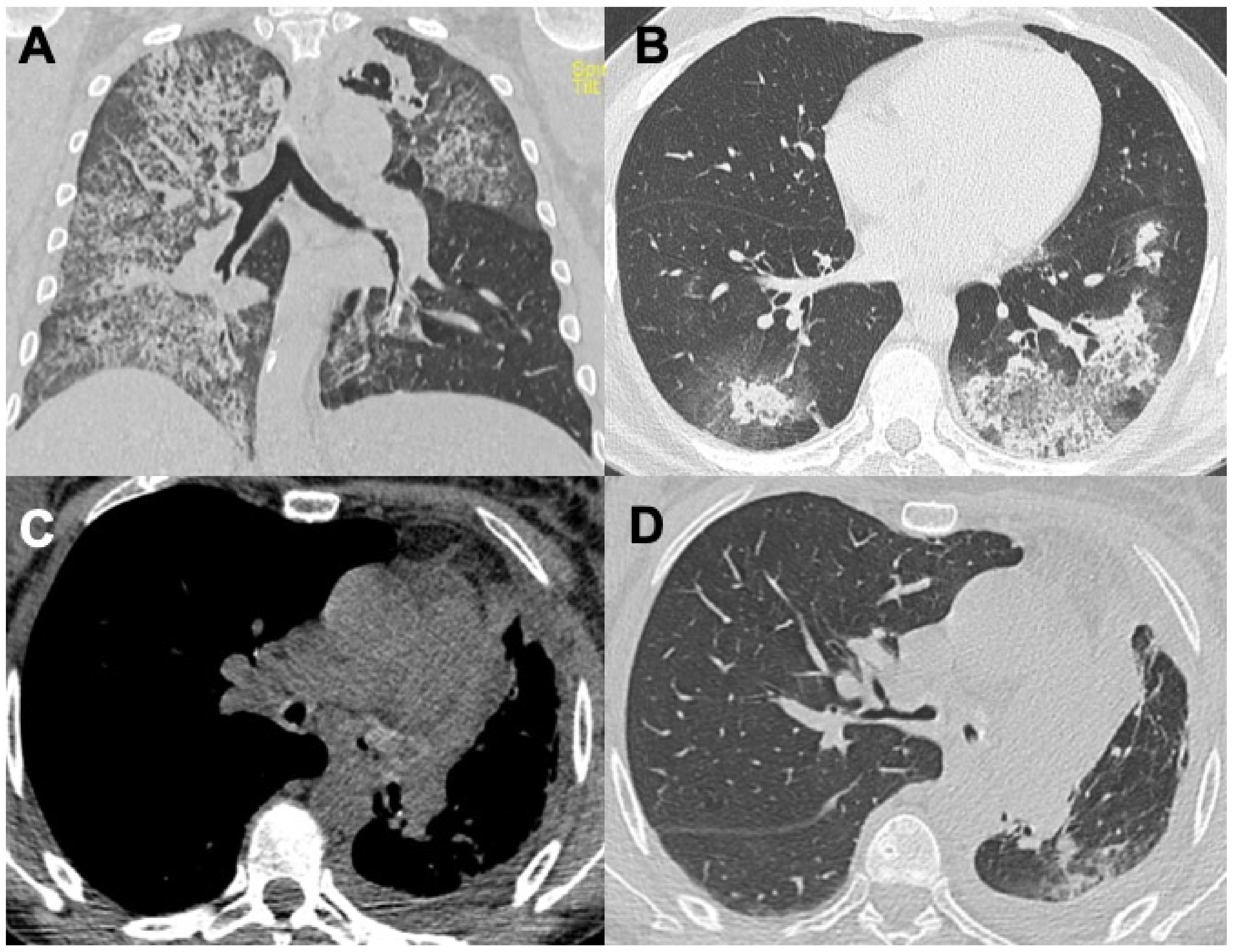 Diagnostics 14 01416 g001