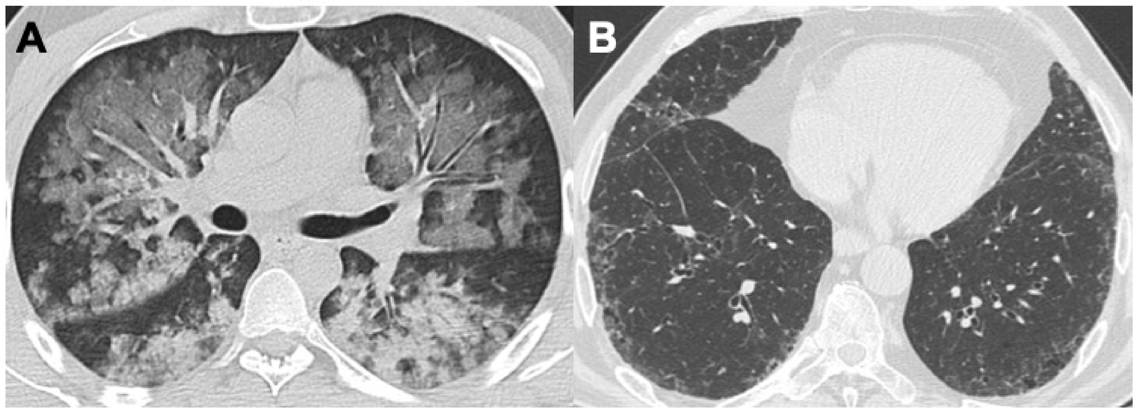 Diagnostics 14 01416 g002