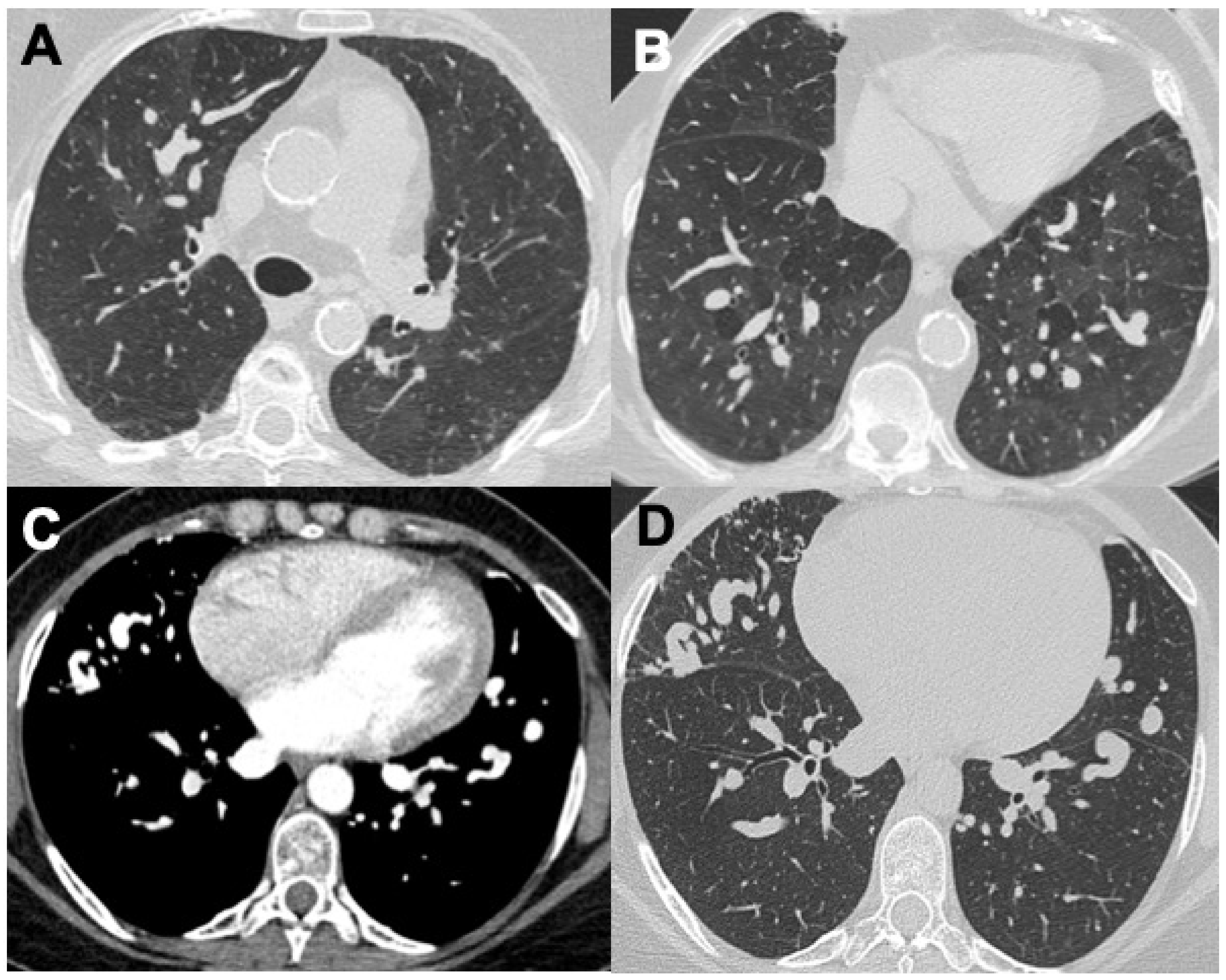 Diagnostics 14 01416 g006