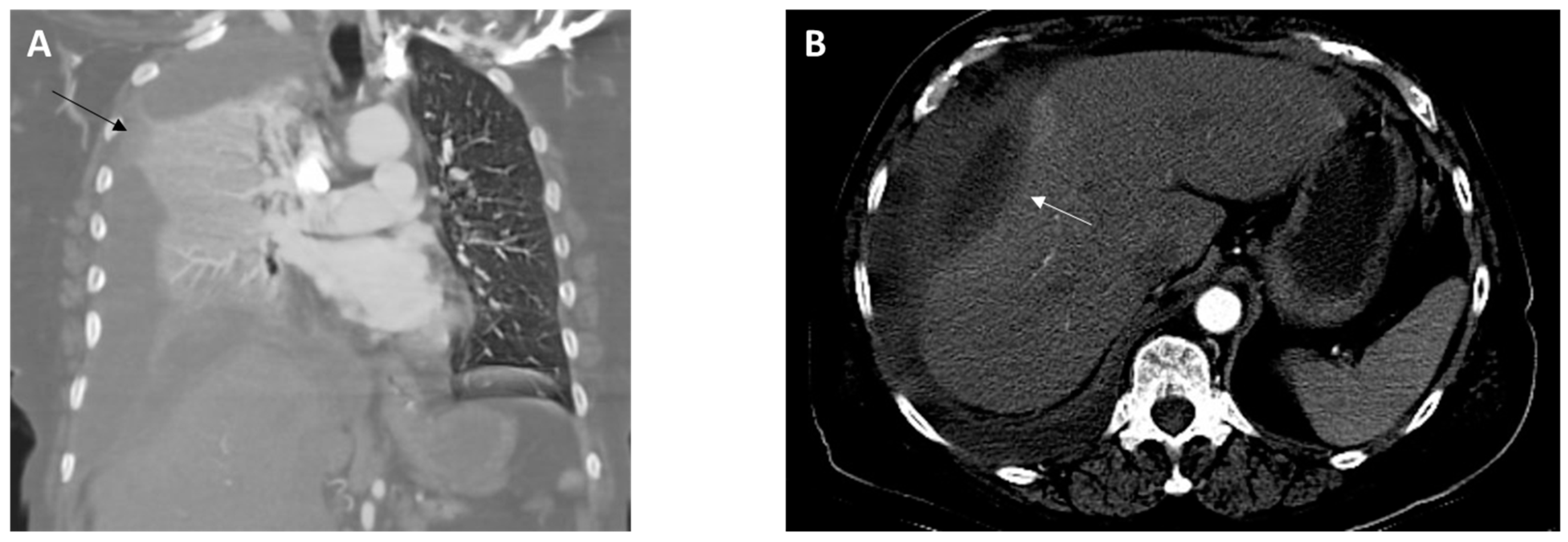 Diagnostics 14 01421 g001