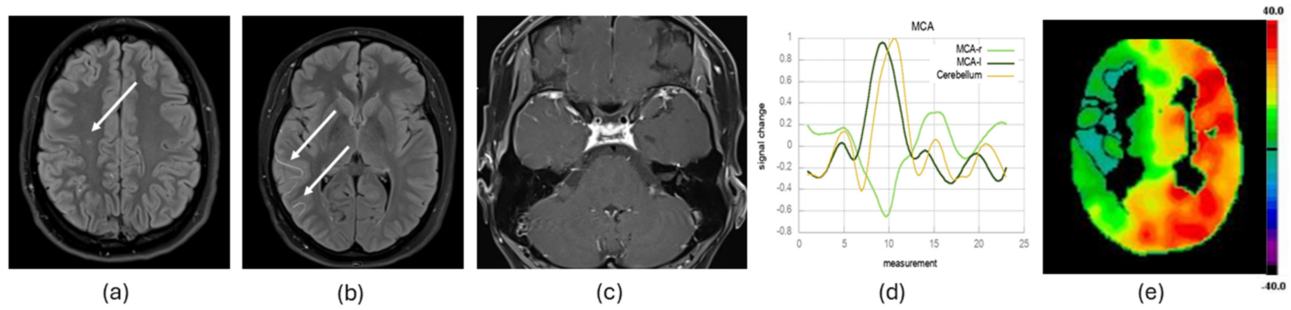 Diagnostics 14 01437 g001